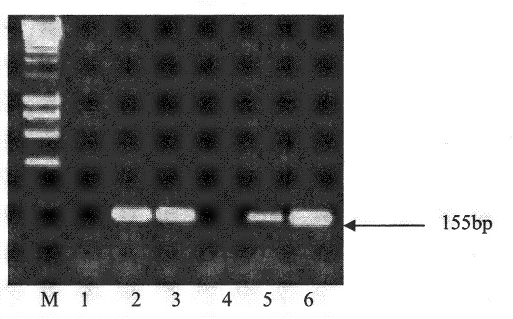 Rapid detection method of real-time PCR for banana bunchy top virus