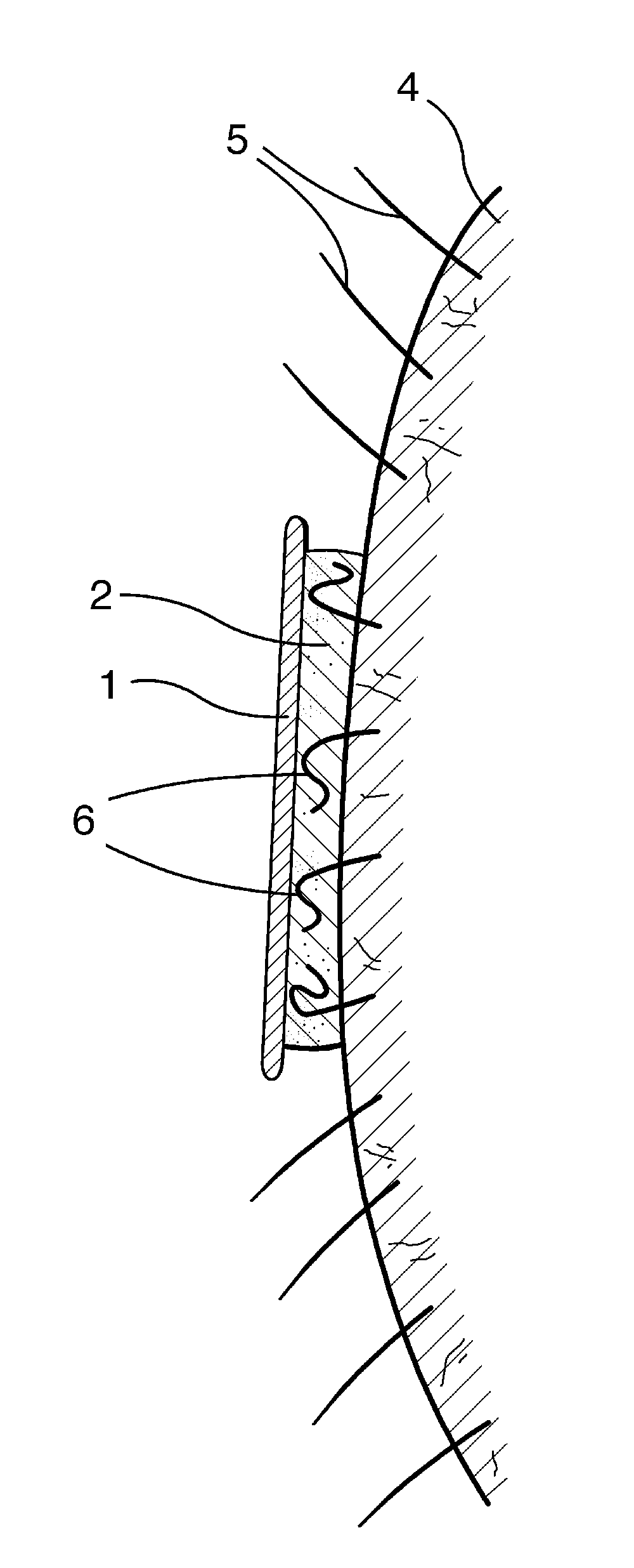 Conformable Depilatory Article