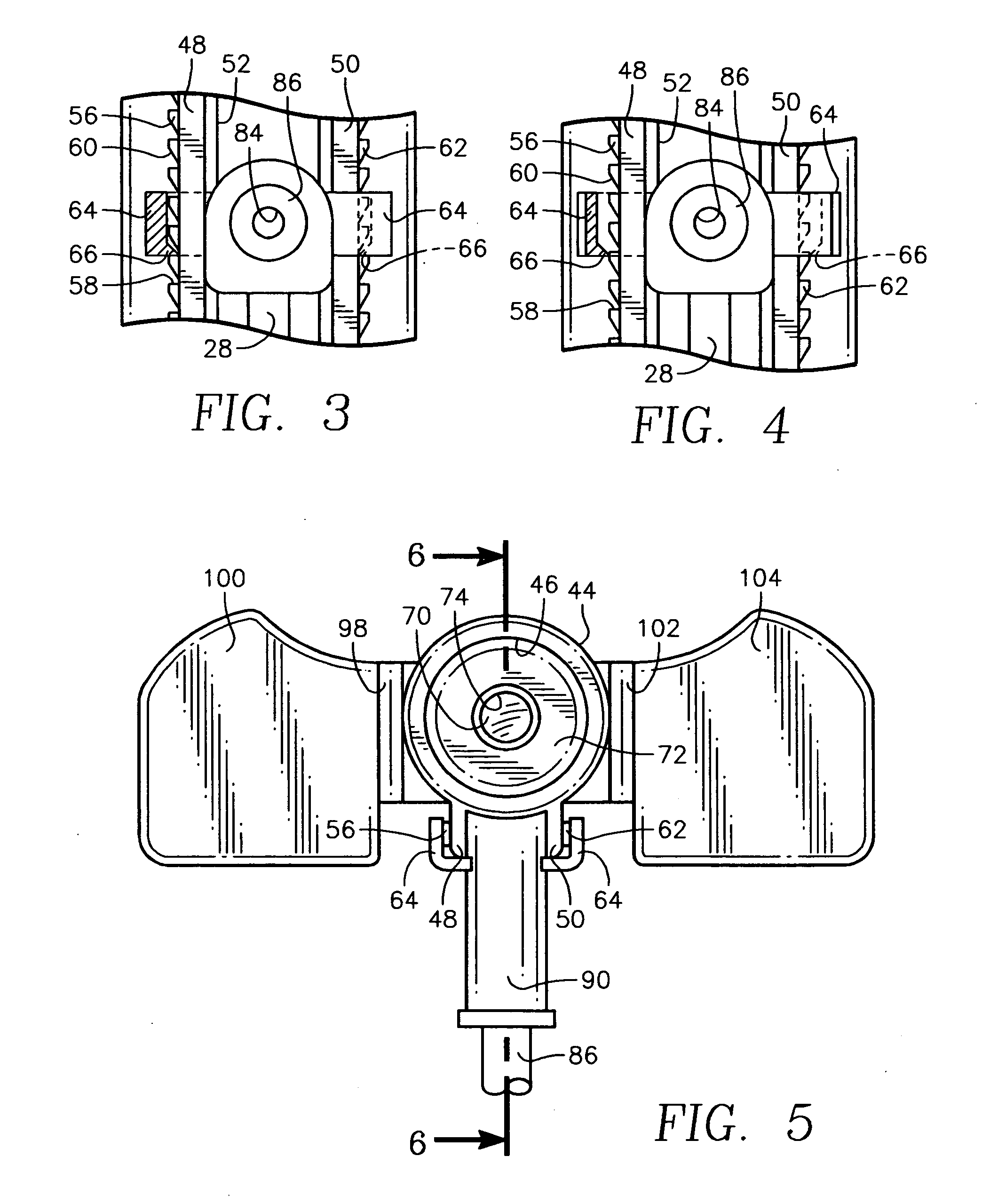 Adjustable medication infusion injection apparatus
