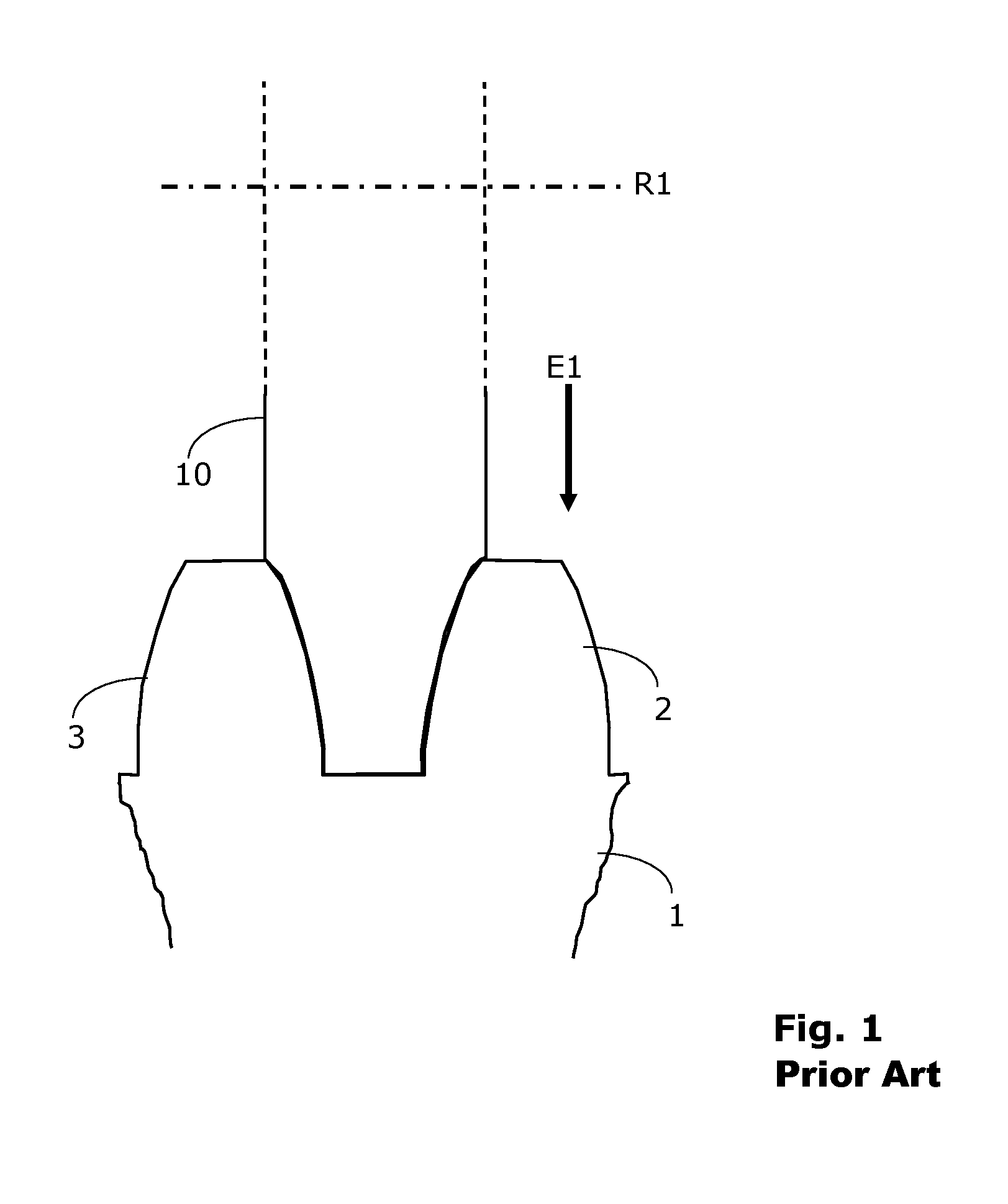Method for ascertaining topography deviations of a dressing tool in a grinding machine