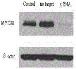 Oligomerization nucleic acid inhibiting MYD88 gene and application of oligomerization nucleic acid