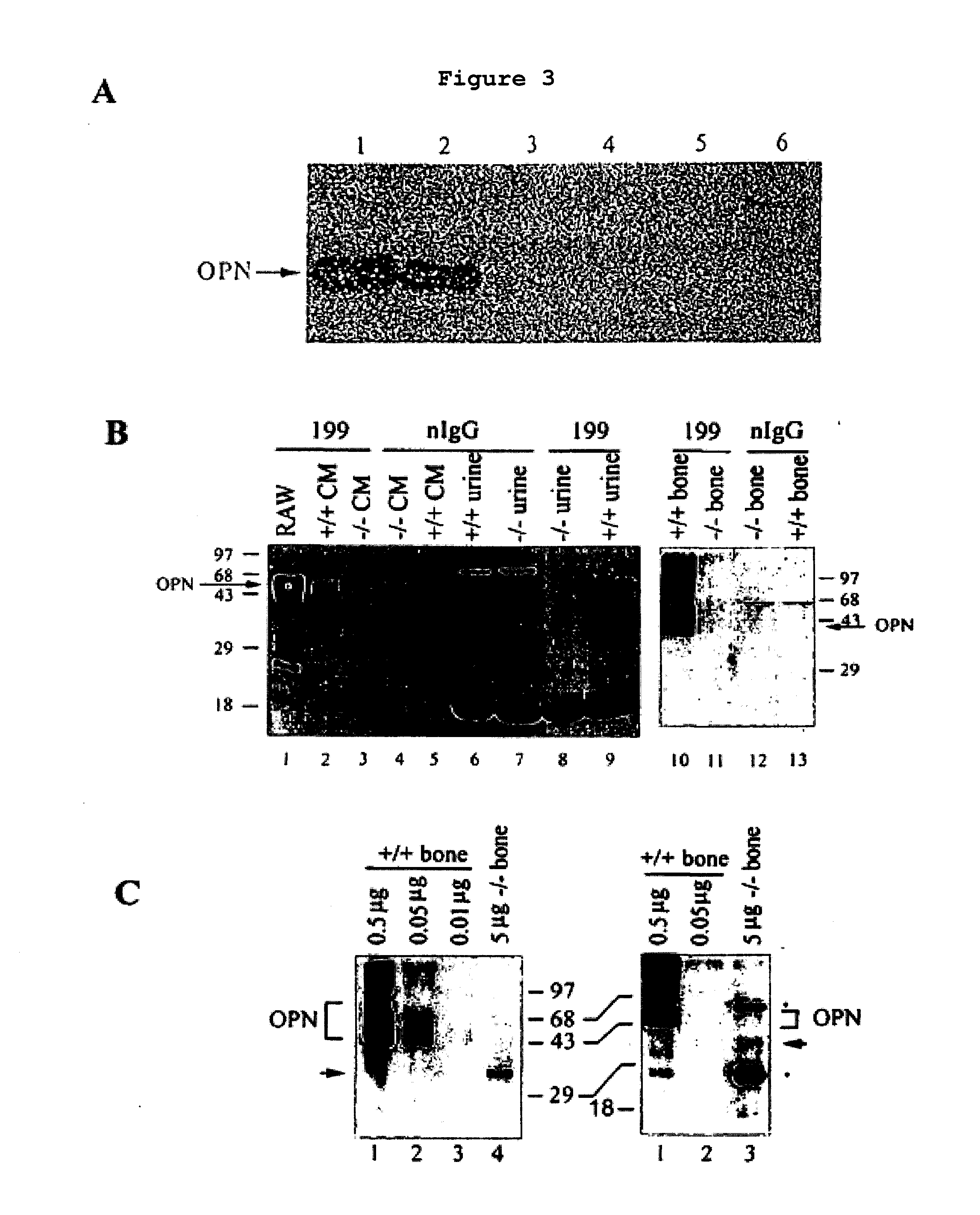 Osteopontin Specific Antibodies and Methods of Use Thereof