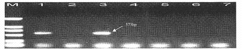 Special primer for identifying which variety of Glu-A3 protein subunit is carried in wheat as well as application thereof