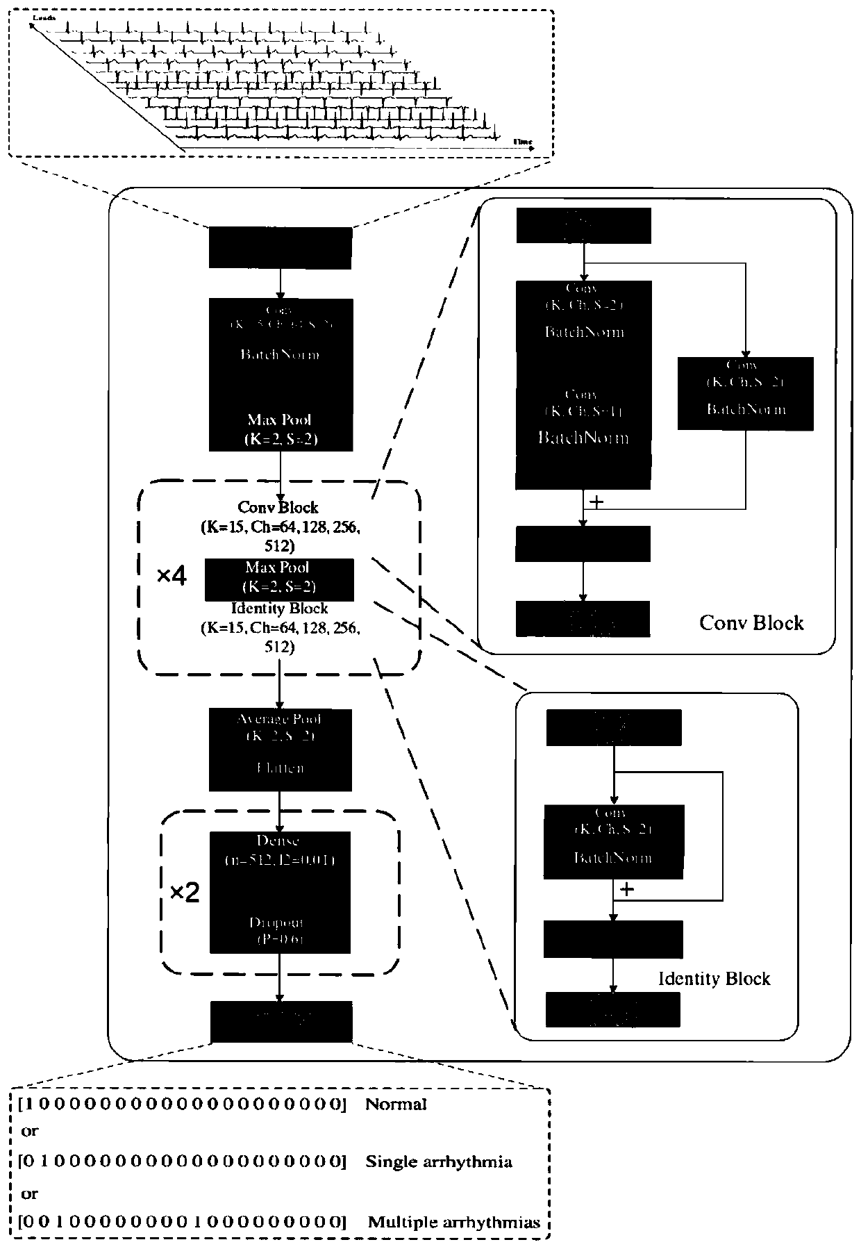 Automatic electrocardiogram classification method, system and device based on deep learning