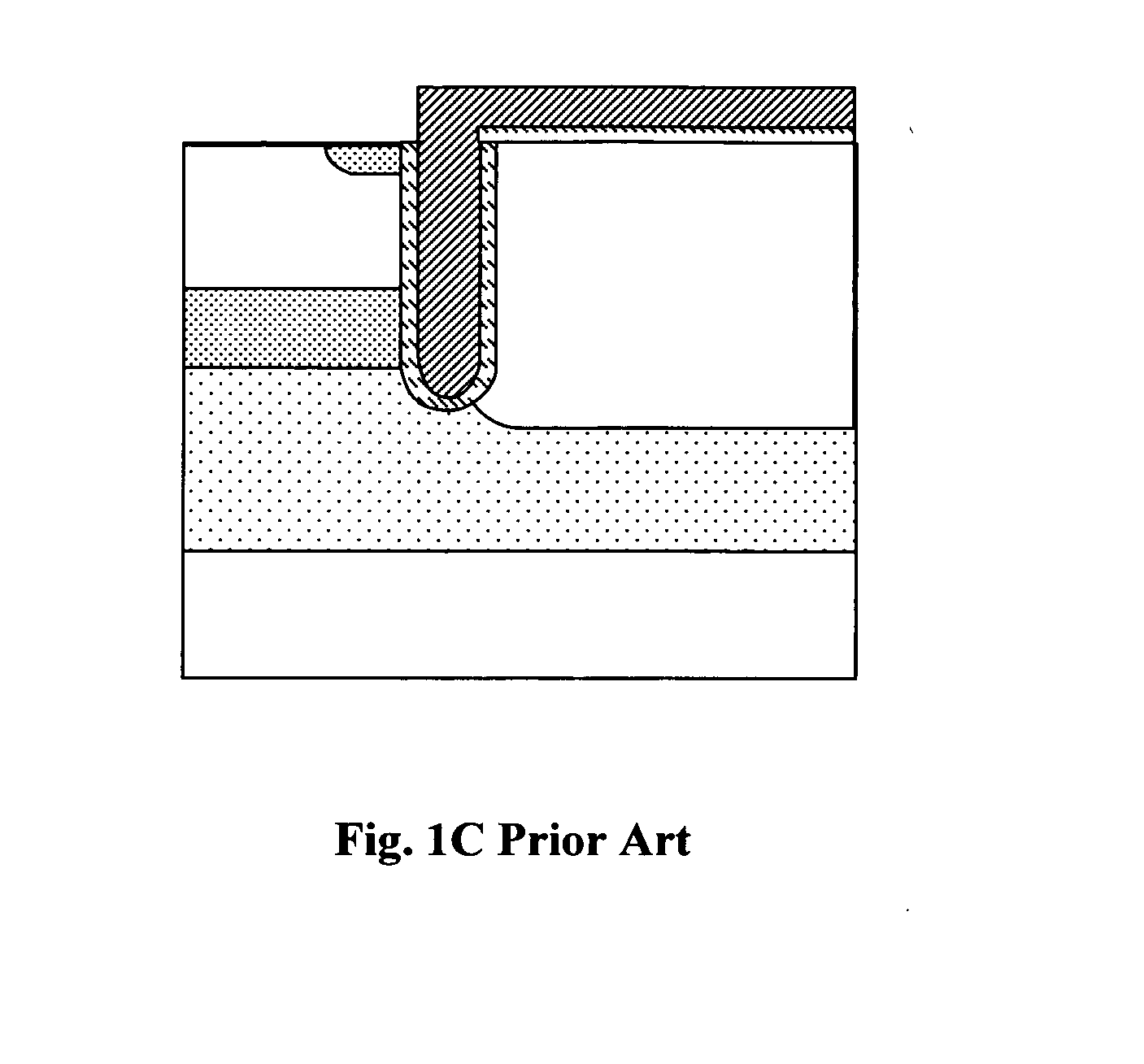 Topside structures for an insulated gate bipolar transistor (IGBT) device to achieve improved device performances