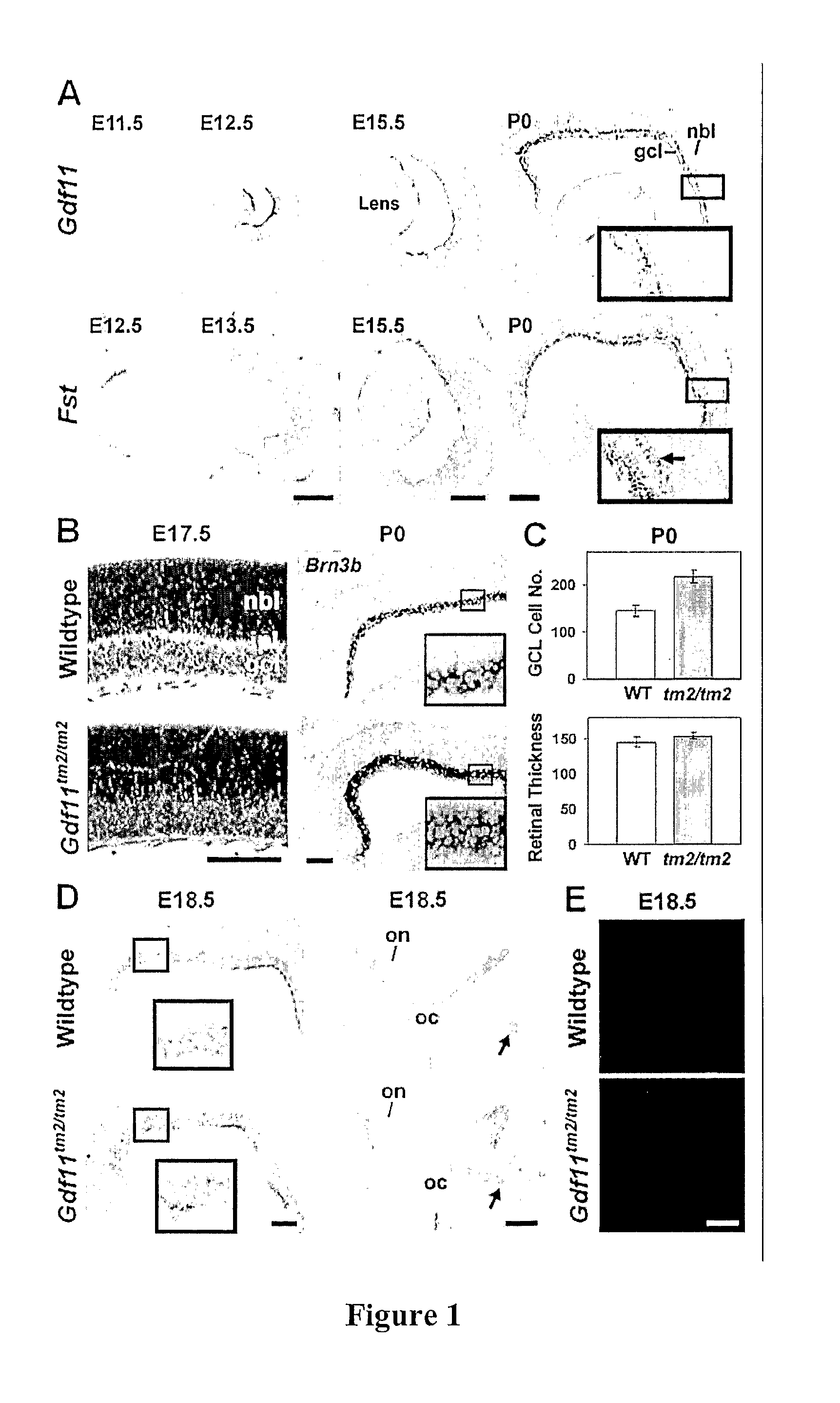 Compositions And Methods For Treatment of Neural Disorders Using Transforming Growth Factor-Beta Superfamily Proteins And Their Antagonists