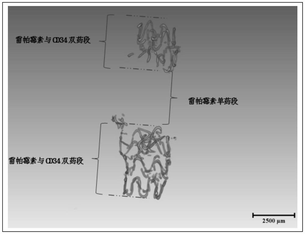 A surface modification method for improving corrosion resistance of magnesium alloy vascular stent