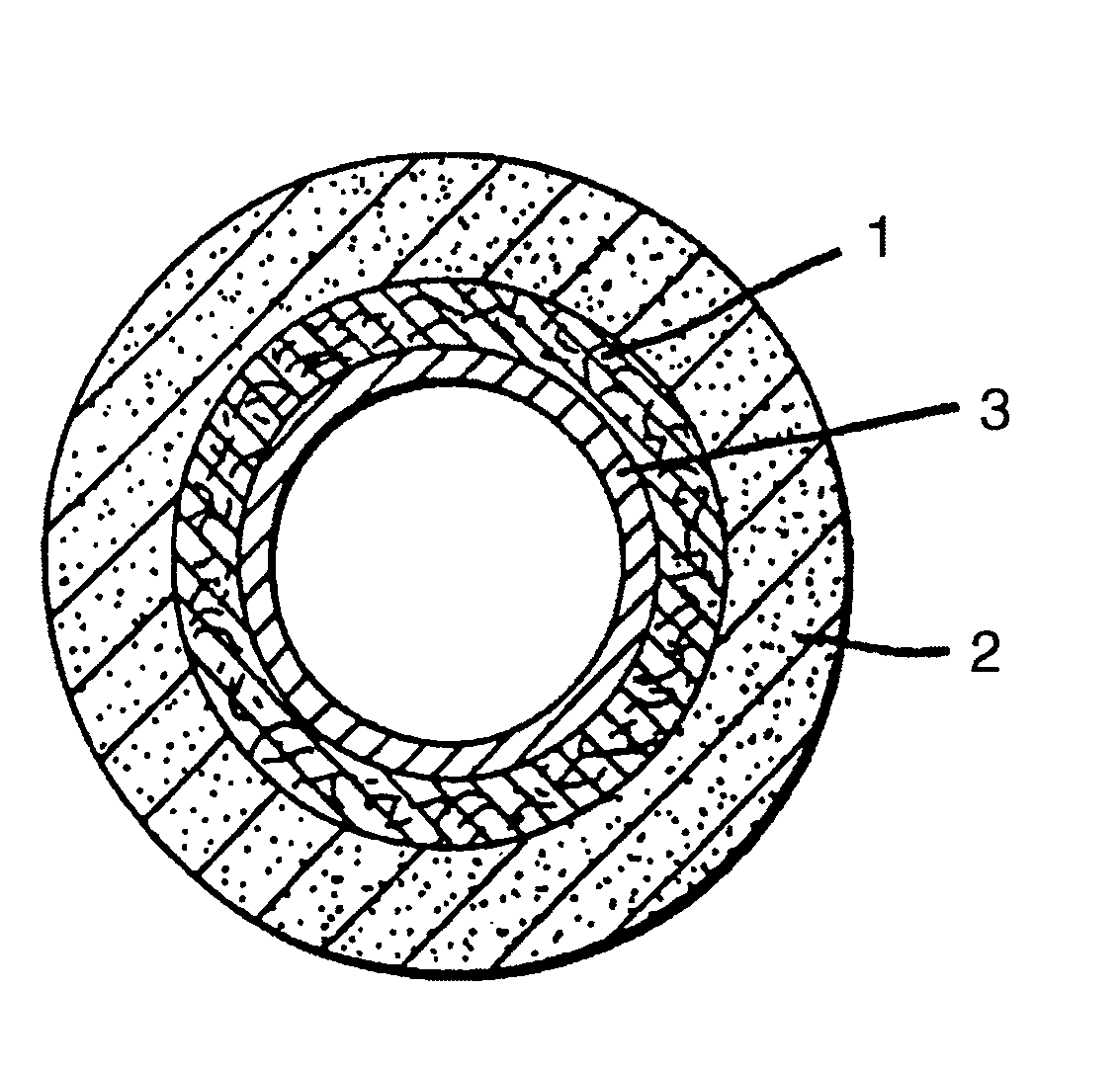 Orthopedic cast system and method