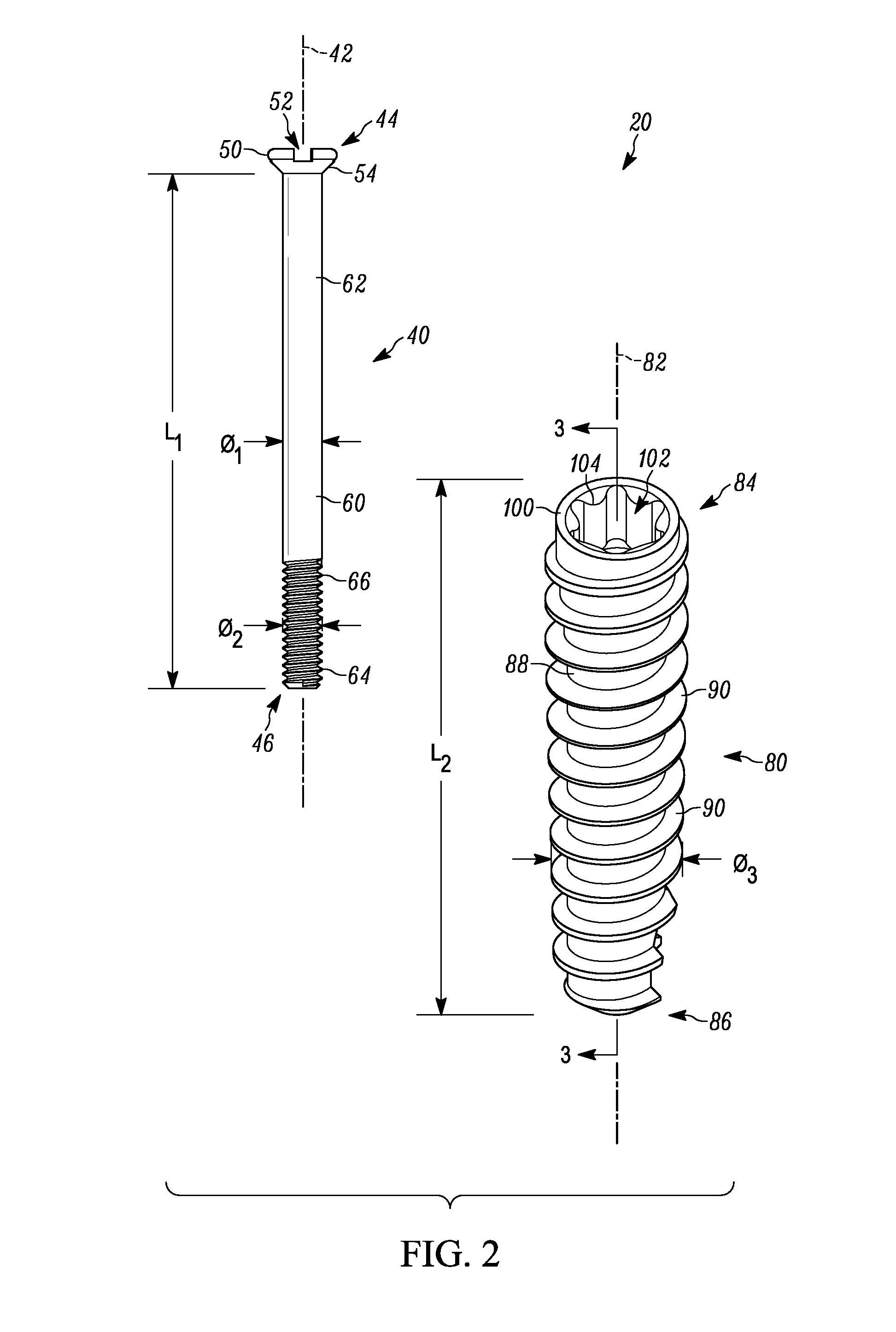 Arthrodesis device and method of use