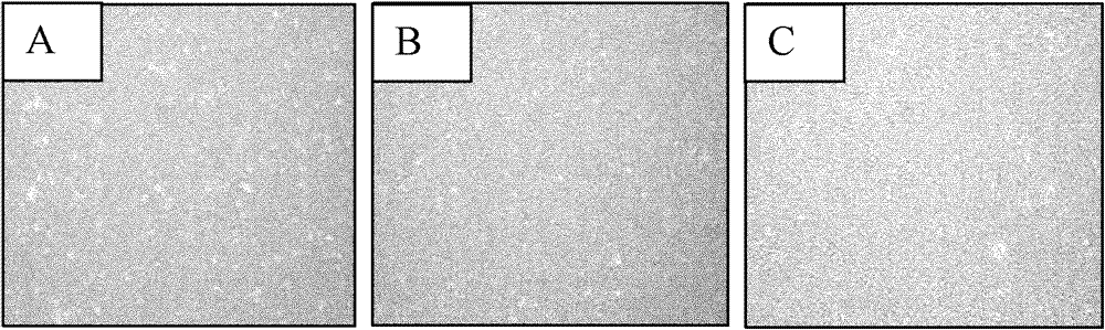 Human umbilical mesenchymal stem cell and preparation method thereof