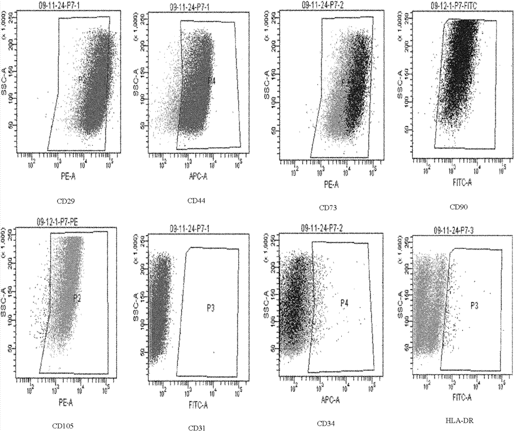 Human umbilical mesenchymal stem cell and preparation method thereof