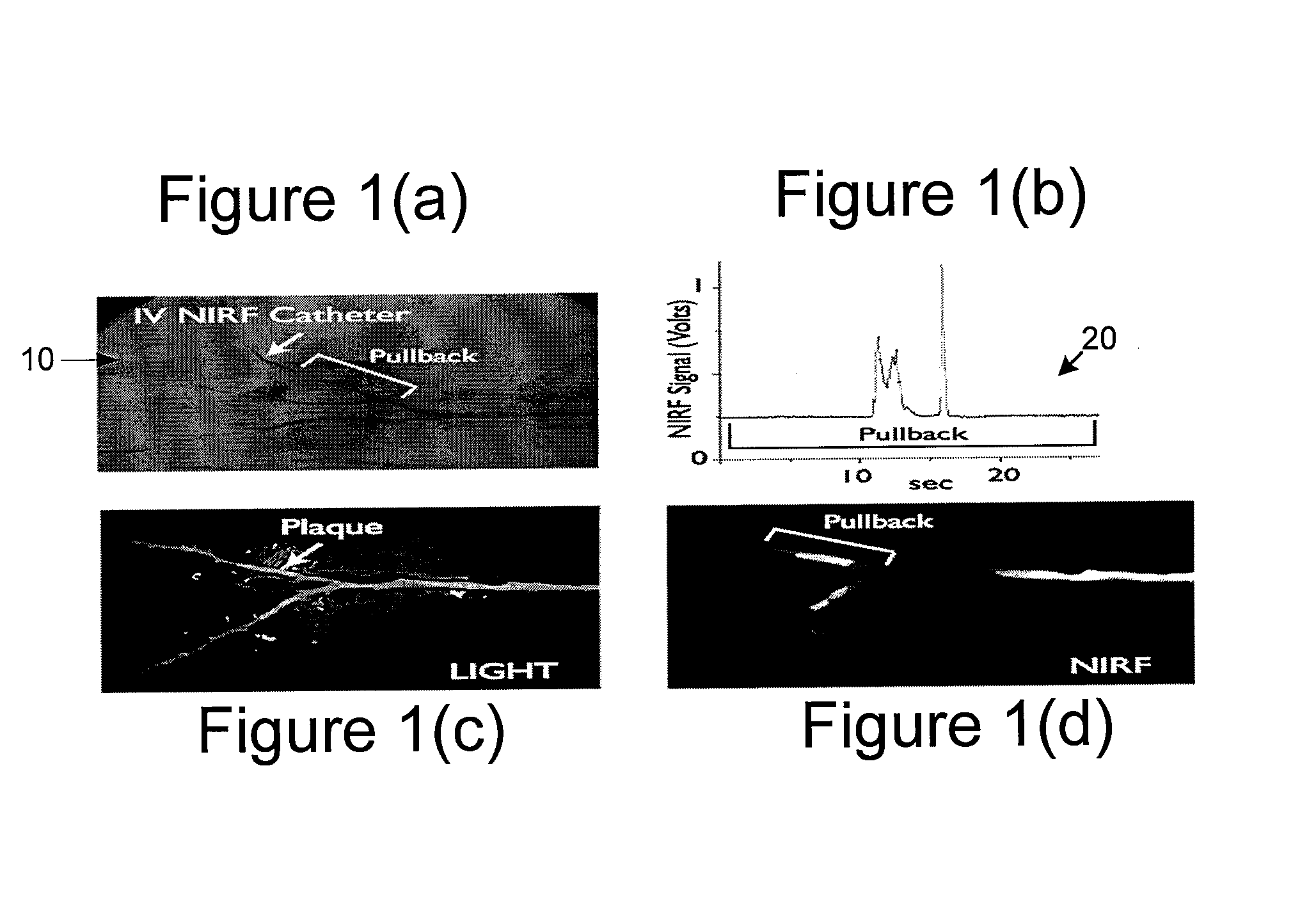 Systems, processes and computer-accessible medium for providing hybrid flourescence and optical coherence tomography imaging