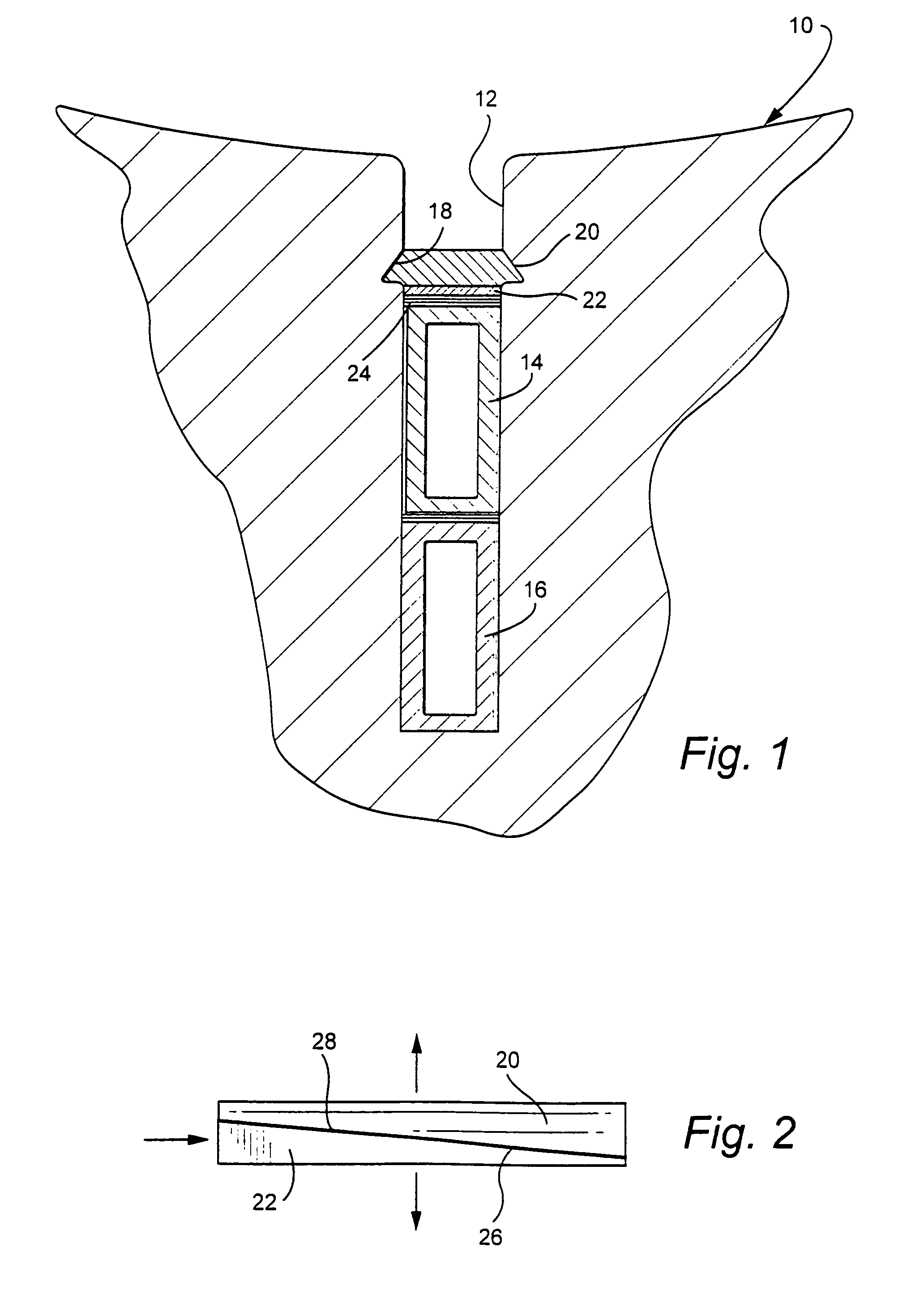 Re-tightenable stator body wedge system