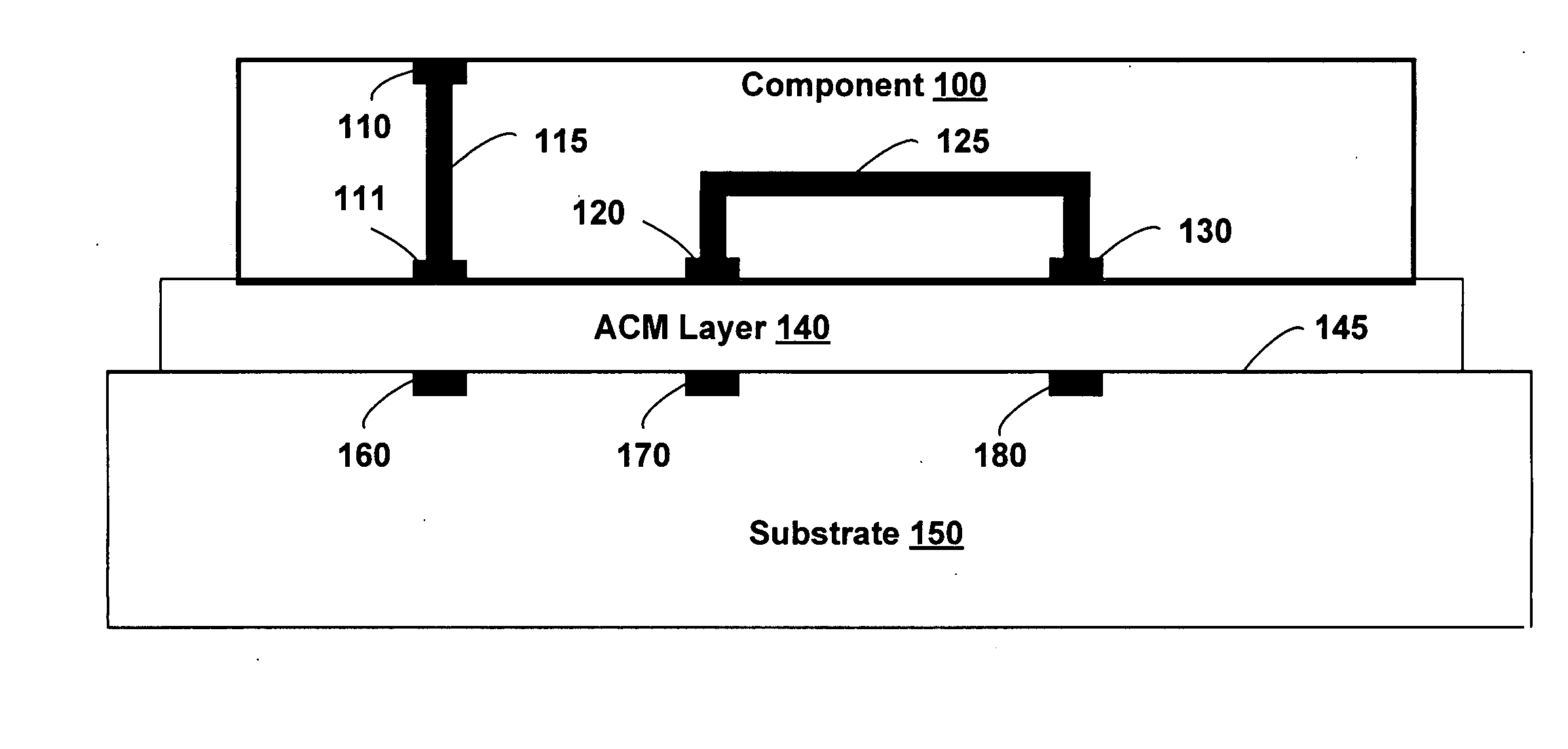 Electronic assembly with detachable components