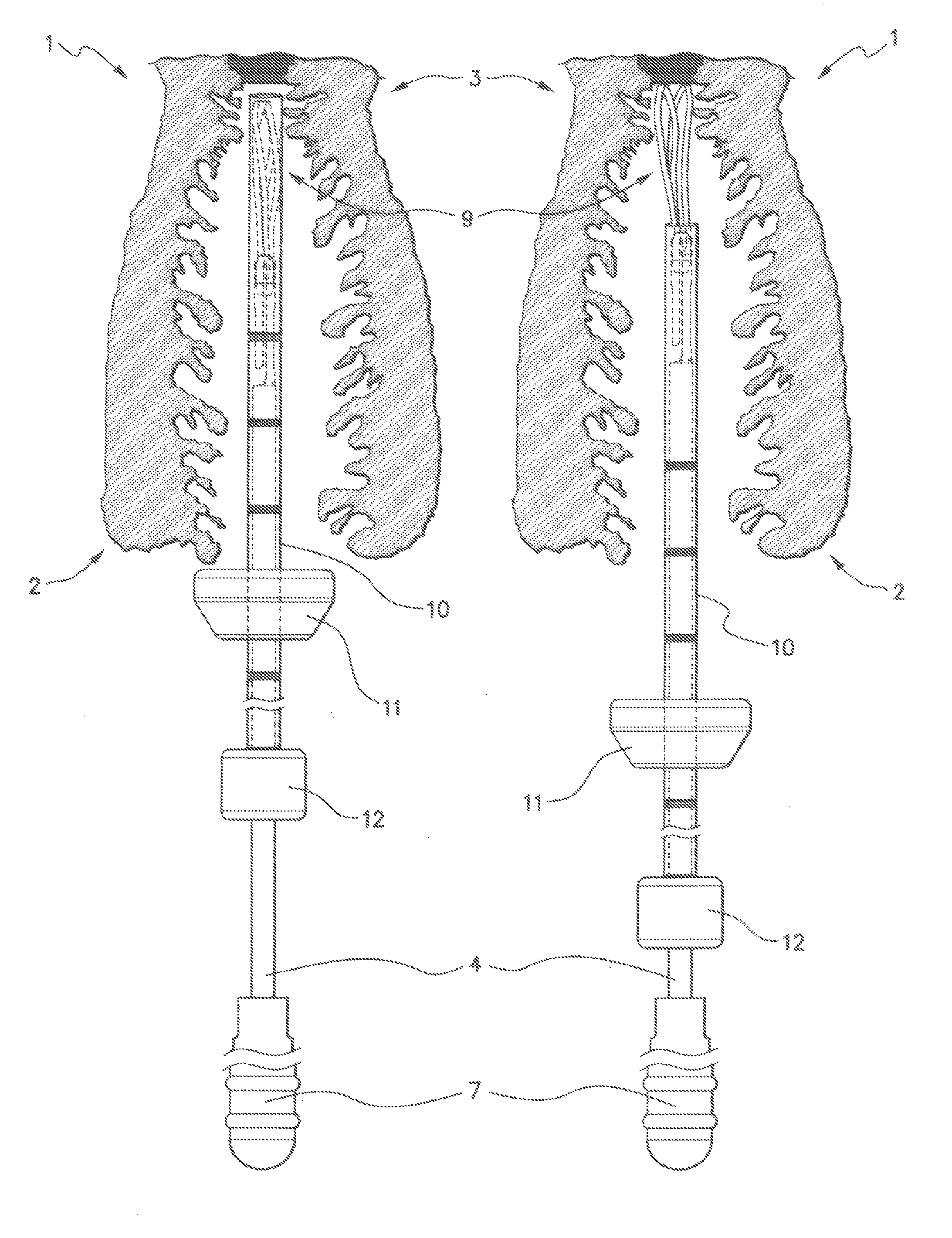 Biological sampling device