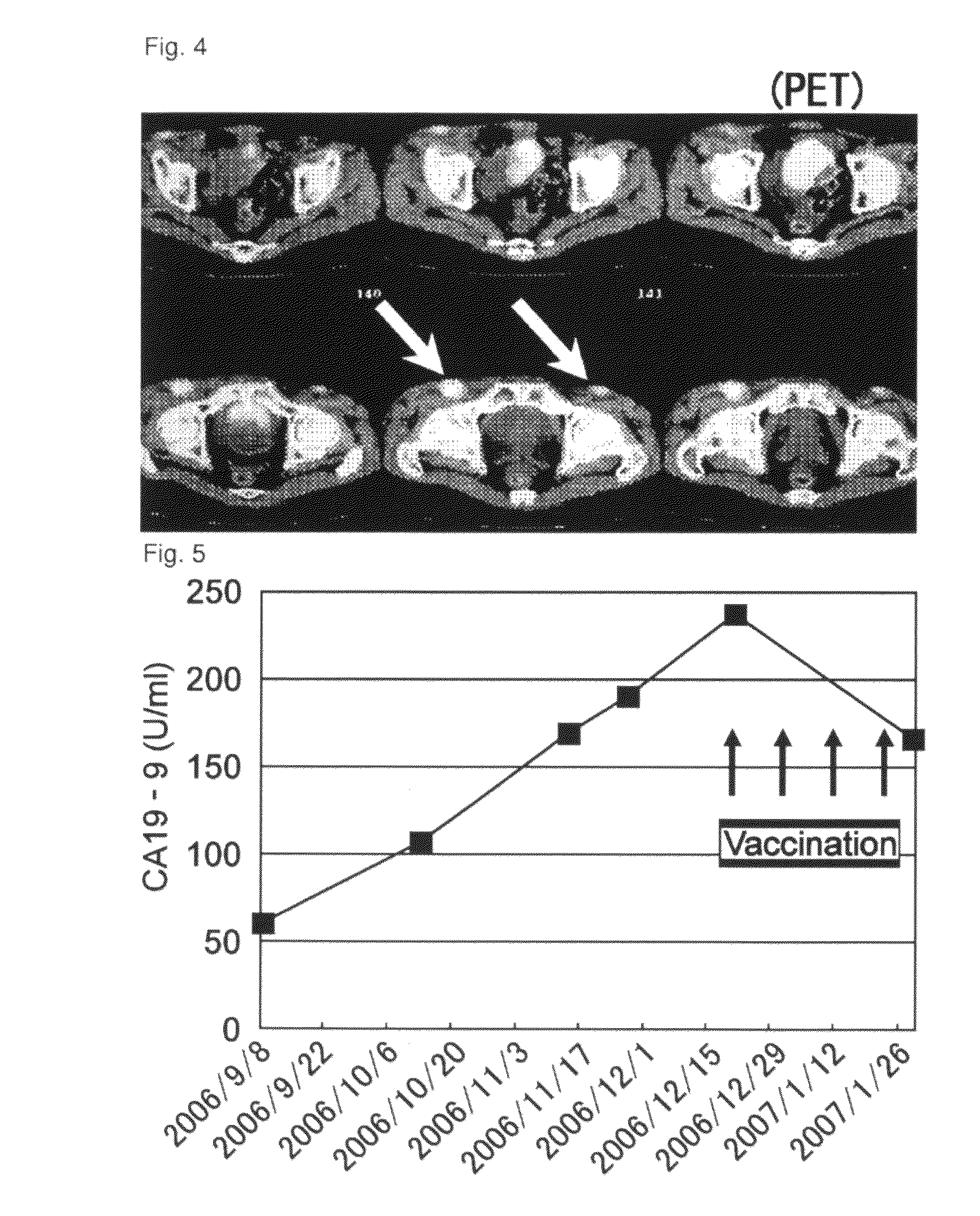 Combination therapy for pancreatic cancer using an antigenic peptide and chemotherapeutic agent