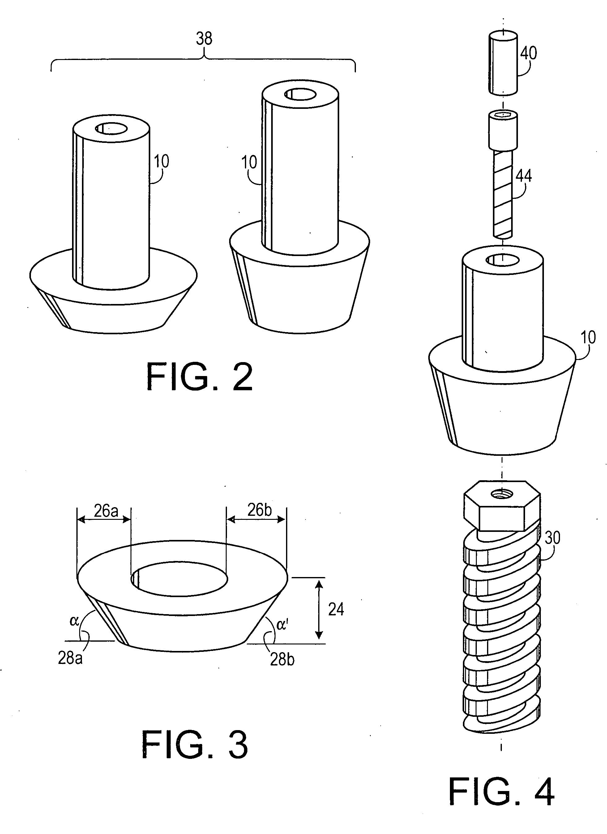 Abutment system and method for preparing the same
