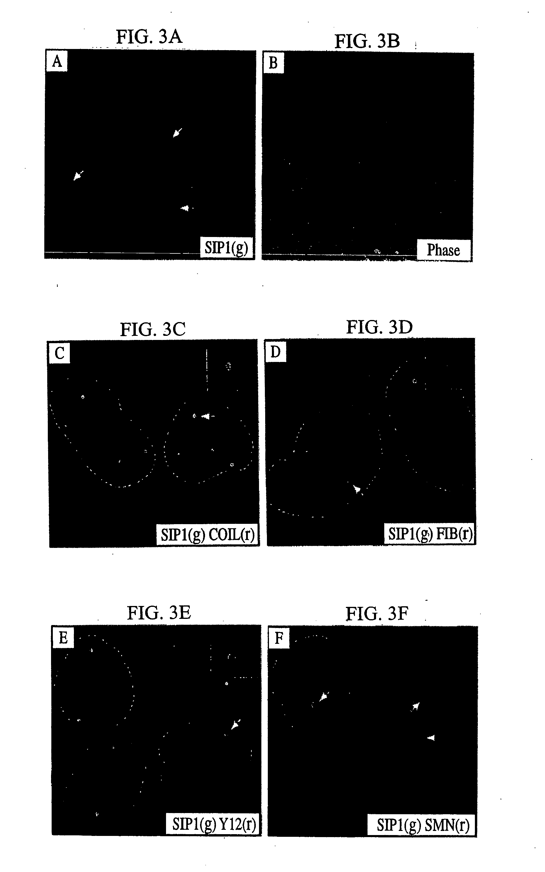 Compositions, methods, and kits useful for the diagnosis and treatment of spinal muscular atrophy