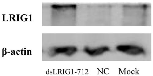 Small RNAs that activate Lrig1 expression in glioma U251 cells, screening methods and their applications