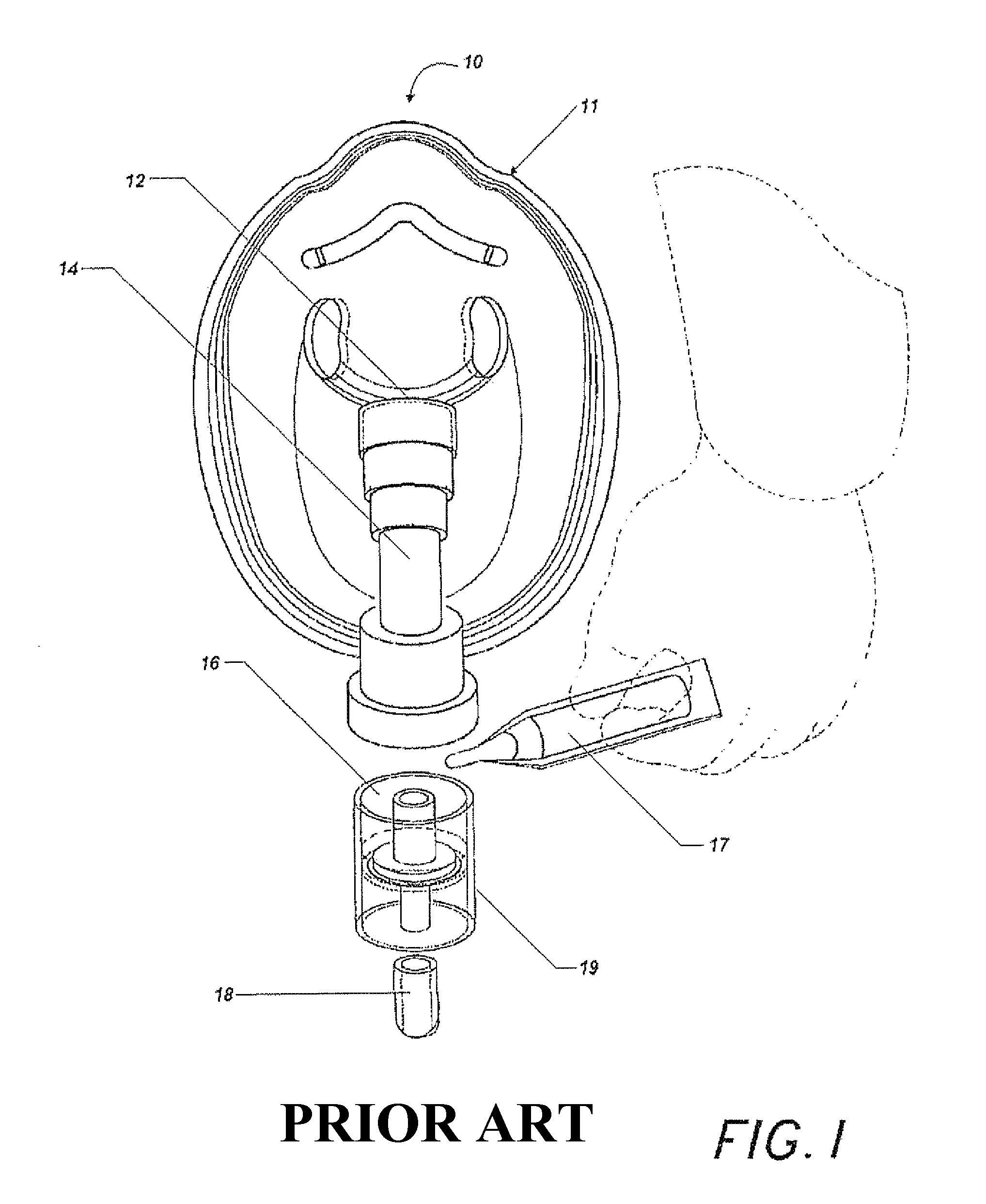 Nebulizer apparatus