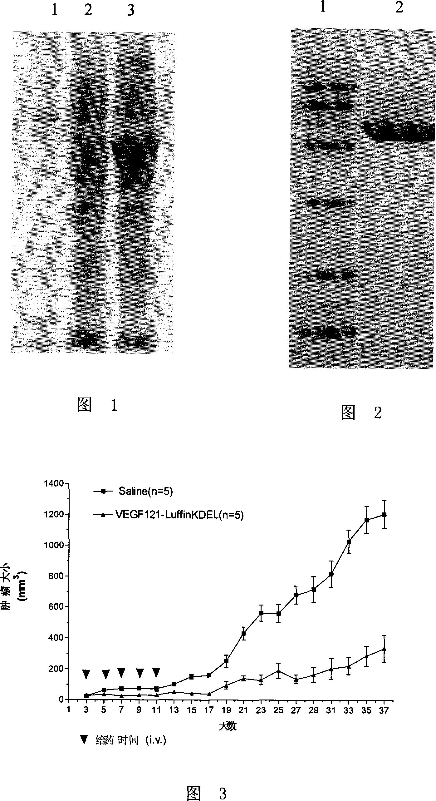 Fusion protein with function of selective killing endothelial cells in tumor neogenetic blood vessels and use thereof