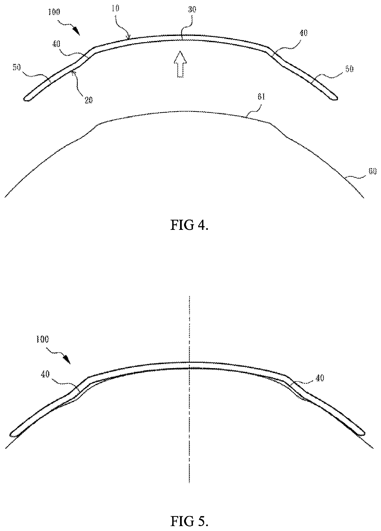 Suction pump orthokeratology lens