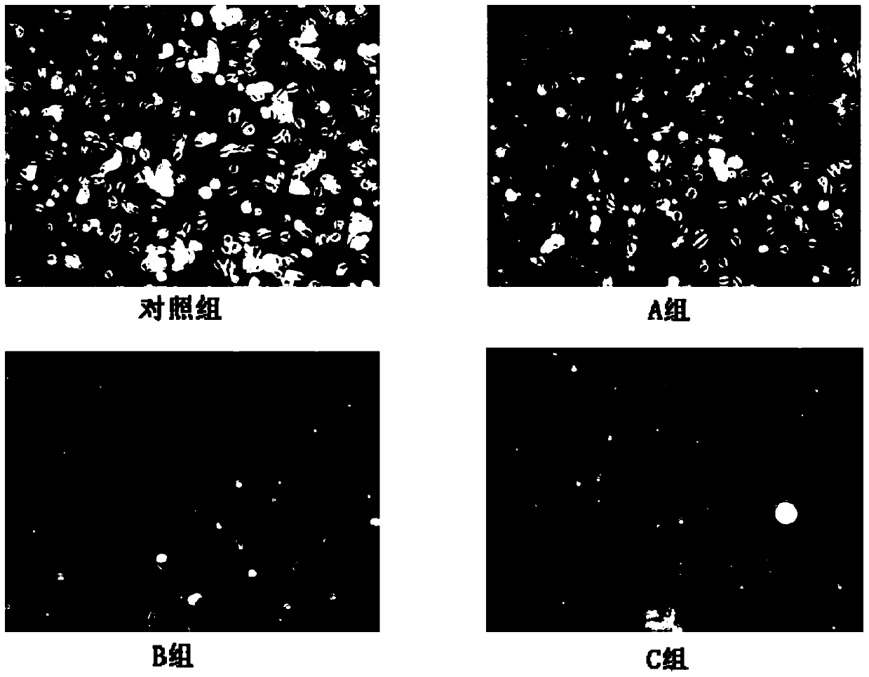Fat graft rich in high activity fatty granule cells and adipose-derived stem cells and preparation method and application of fat graft