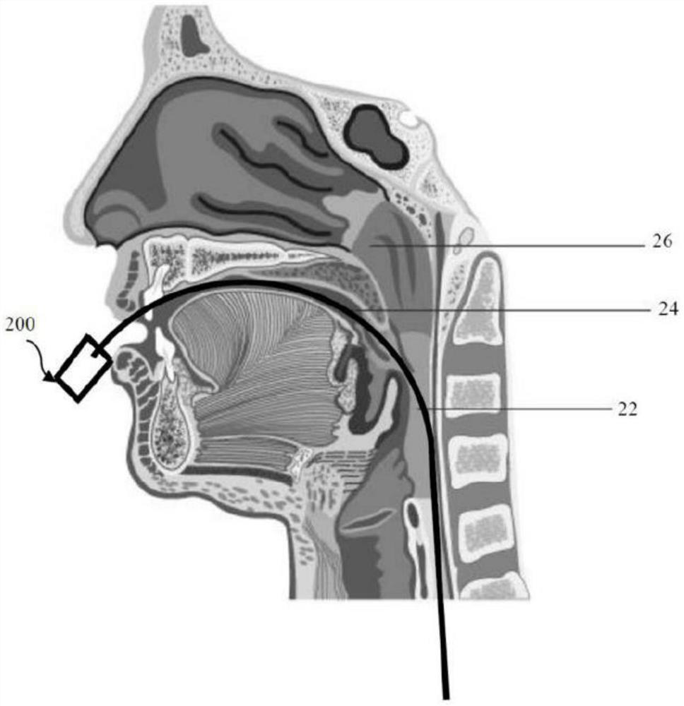 Systems, devices and methods for determining laryngopharyngeal pressure and/or lower oesophageal sphincter pressure