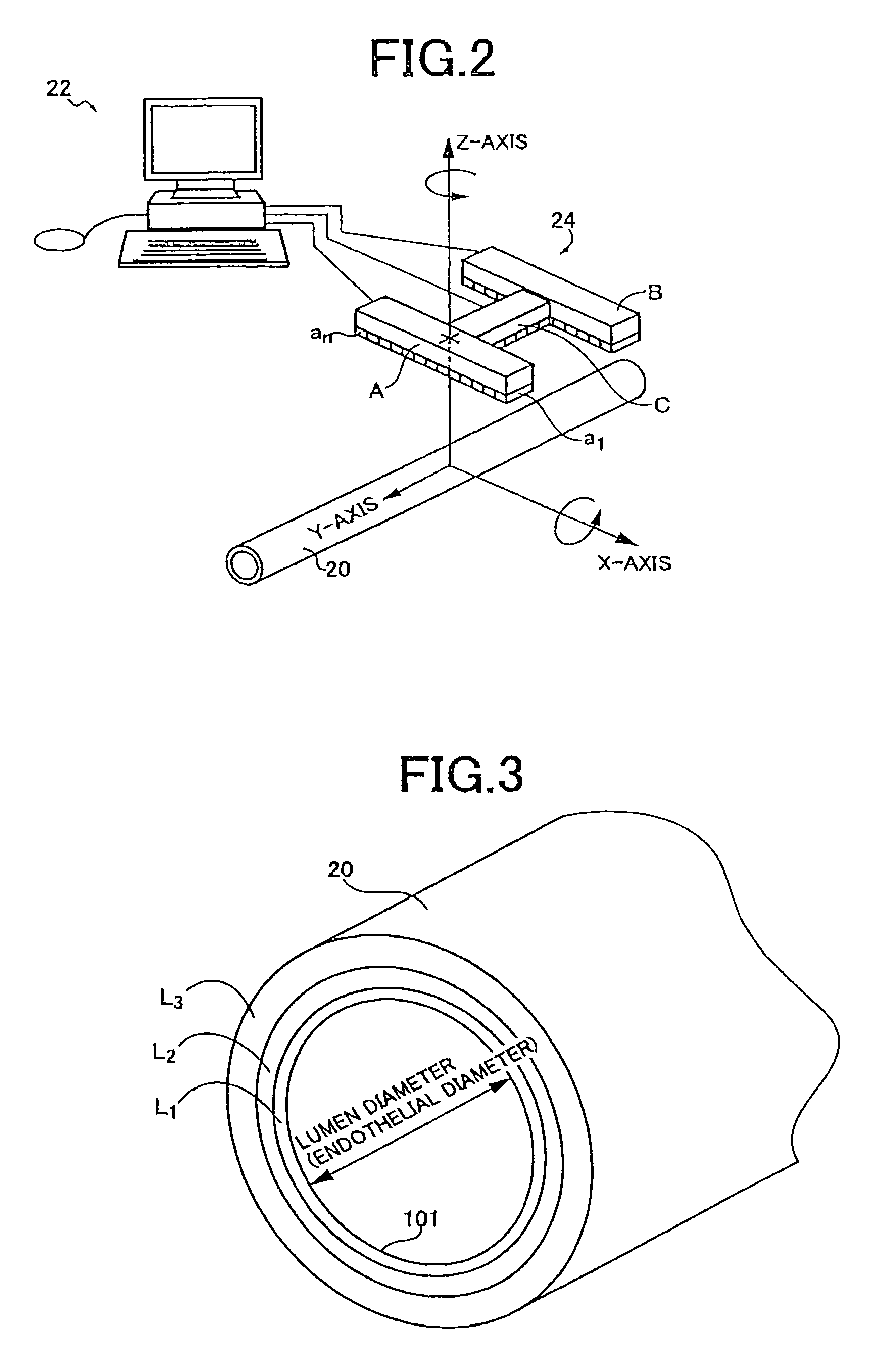 Blood vessel ultrasonic image measuring method