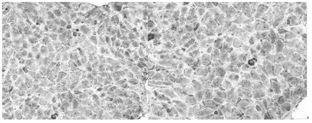 Method for inducing embryonic stem cell into pancreatic tissue-like cells