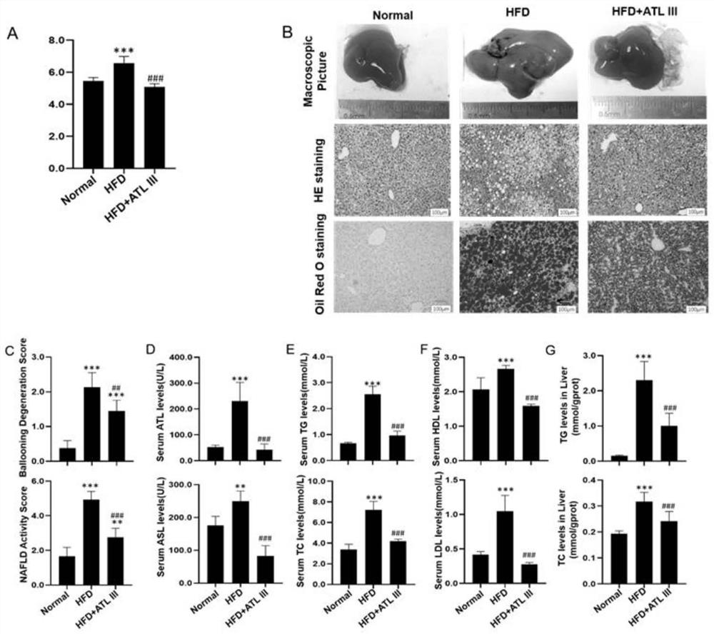 Application of atractylenolide III in preparation of medicine for treating non-alcoholic fatty liver disease