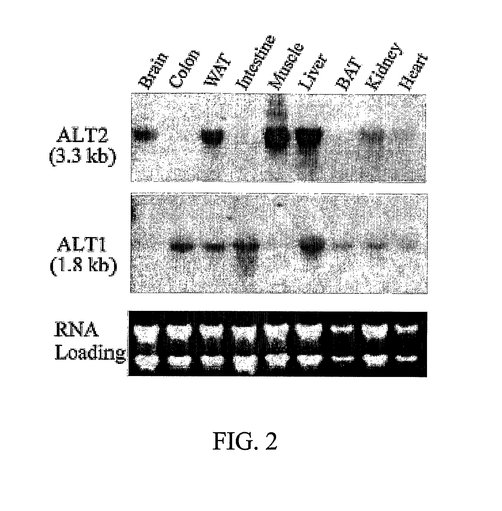 Alanine transaminase enzymes and methods of use