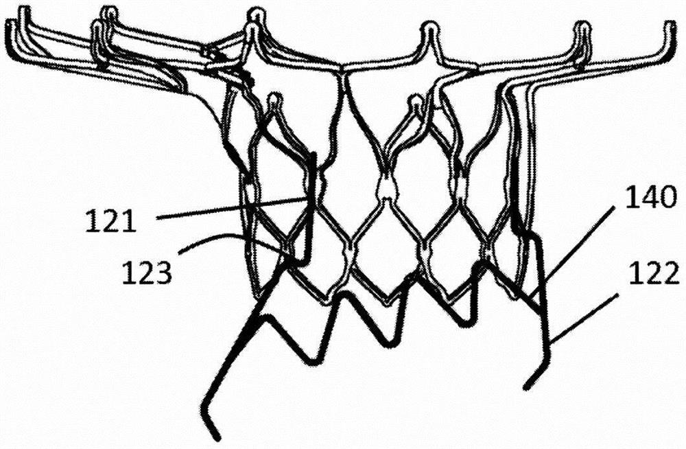 A kind of artificial valve prosthesis with fixer