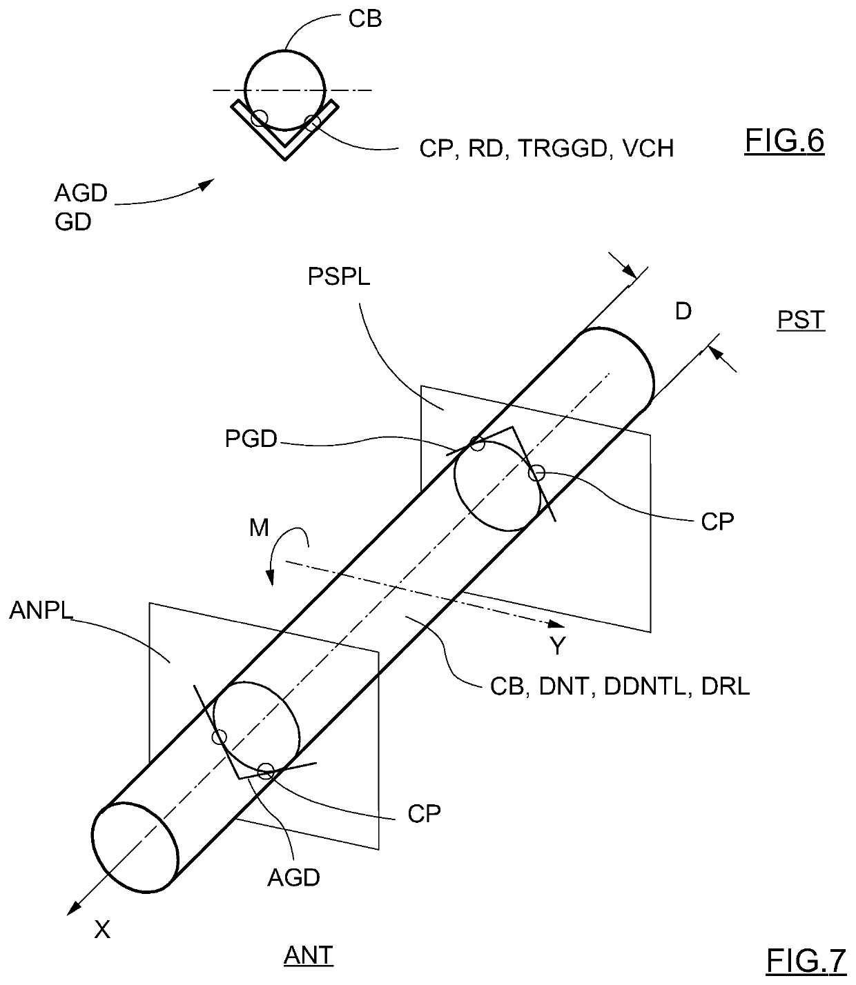 Apparatus for zygomatic implantation and method