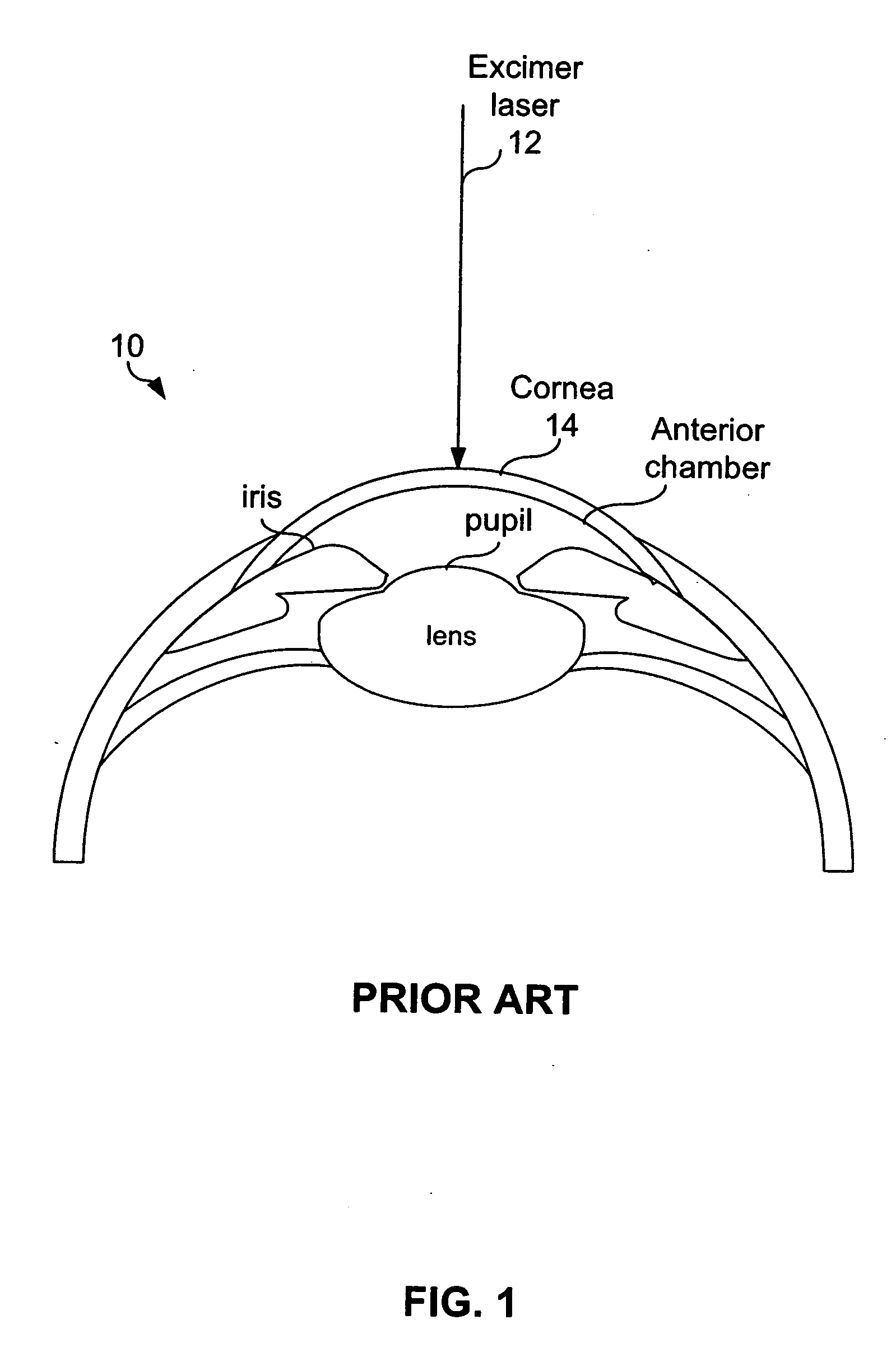 System and method for automatic self-alignment of a surgical laser