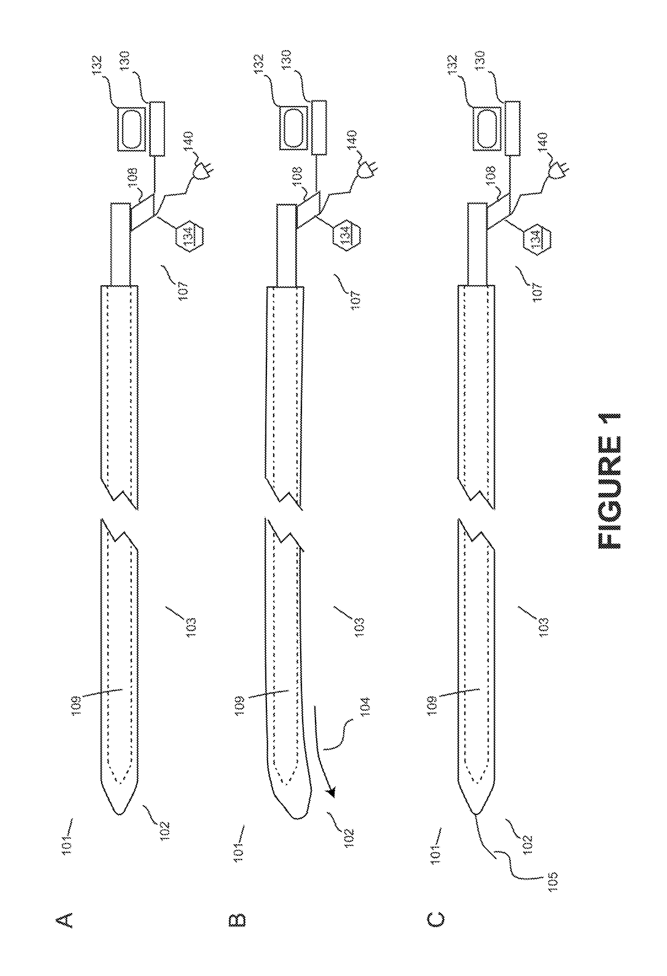 Device for reducing renal sympathetic nerve activity