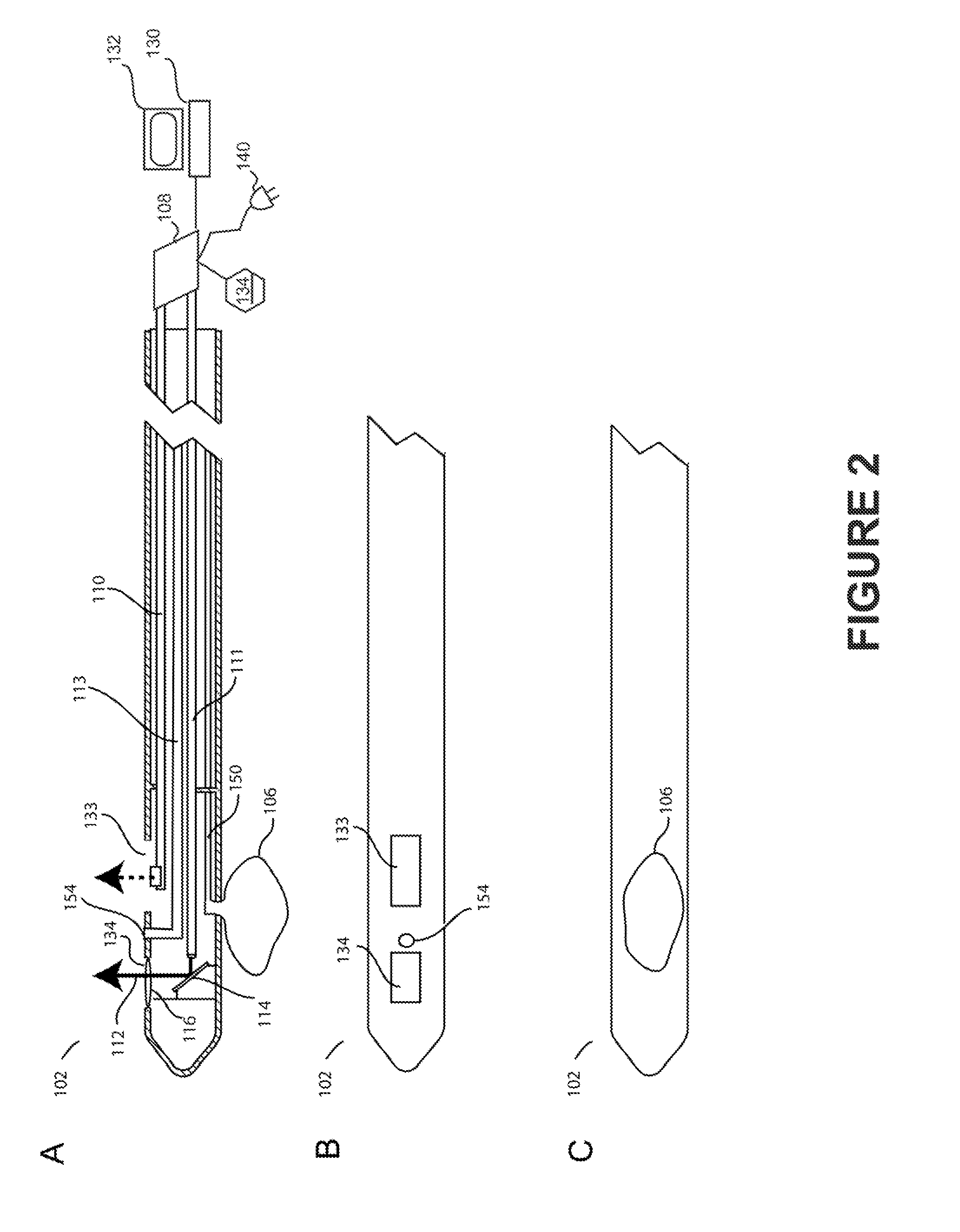 Device for reducing renal sympathetic nerve activity