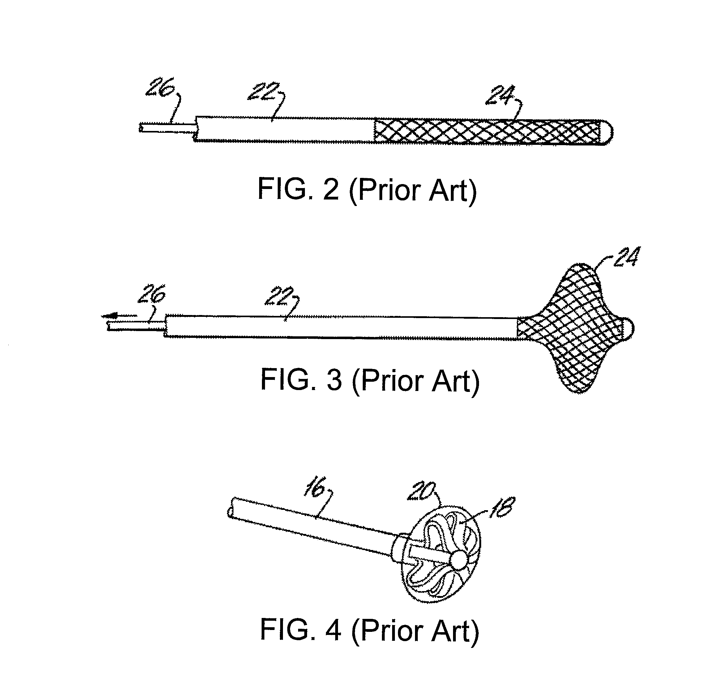 Method for treating a target site in a vascular body channel