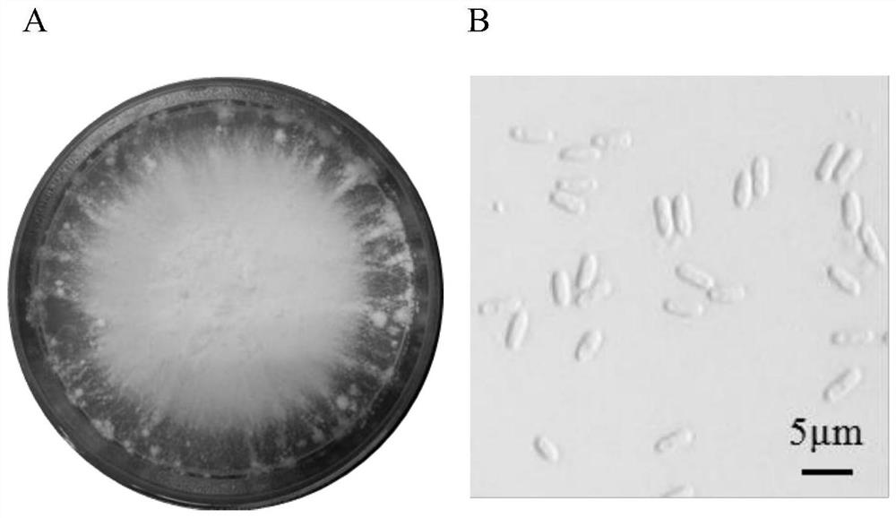 A kind of C. inflata bacterial strain and application thereof