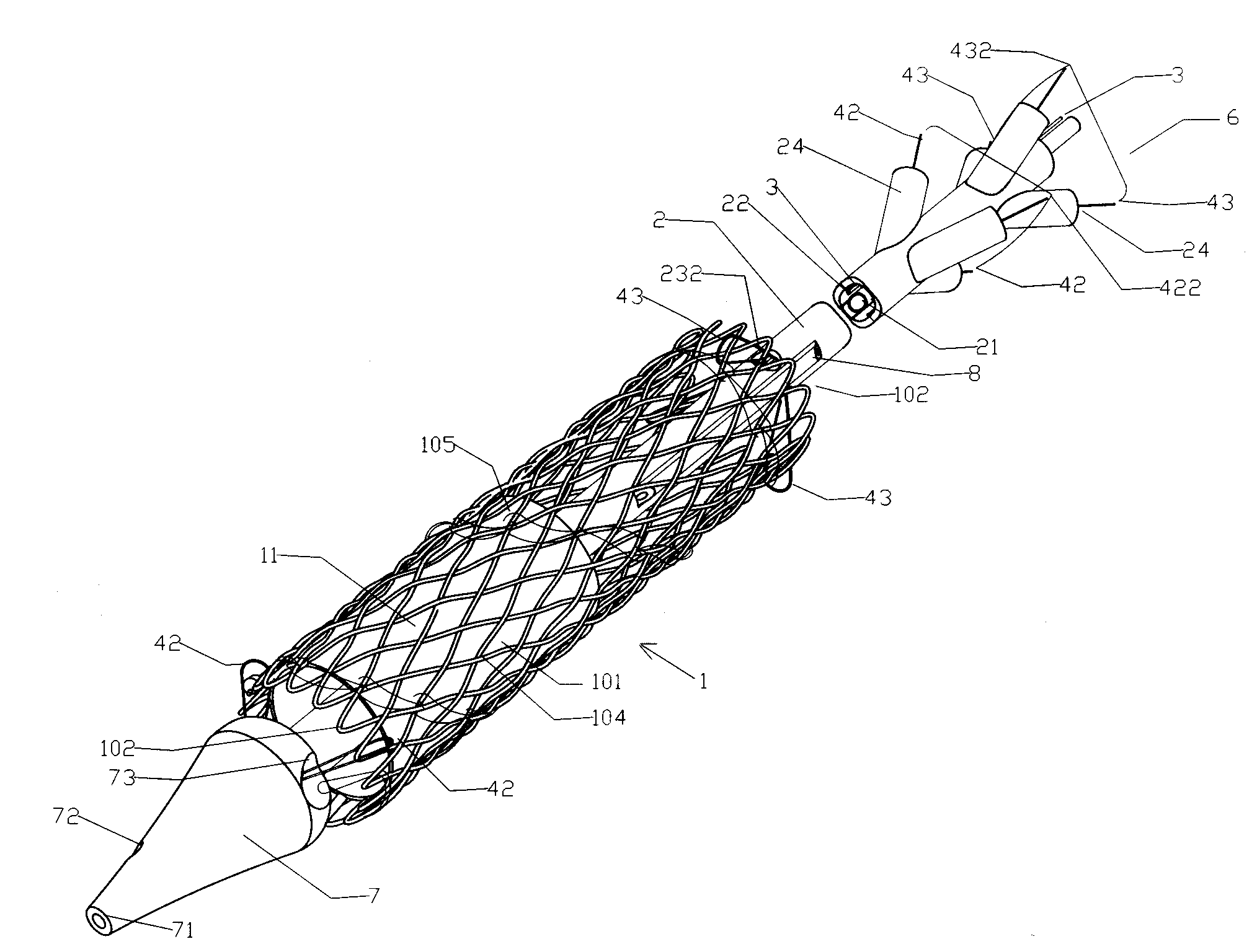 Axial Pullwire Tension Mechanism for Self-Expanding Stent