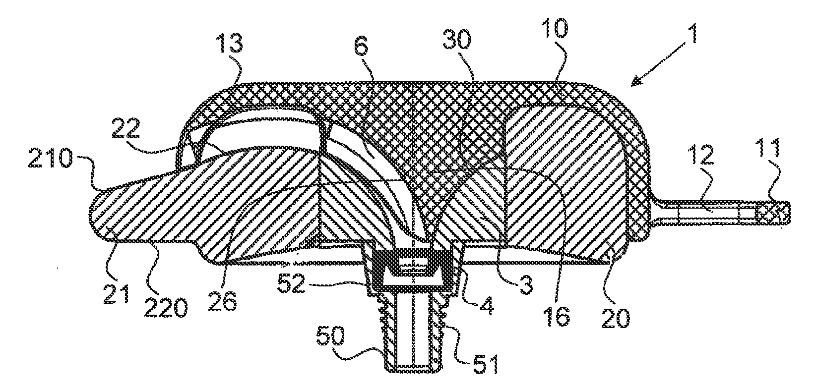 Anchoring device for a line in a skull bore hole
