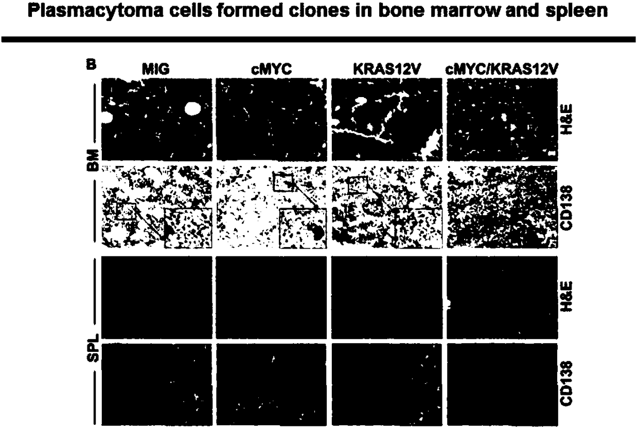 Construction method and application of primary MM (multiple myeloma) mouse model