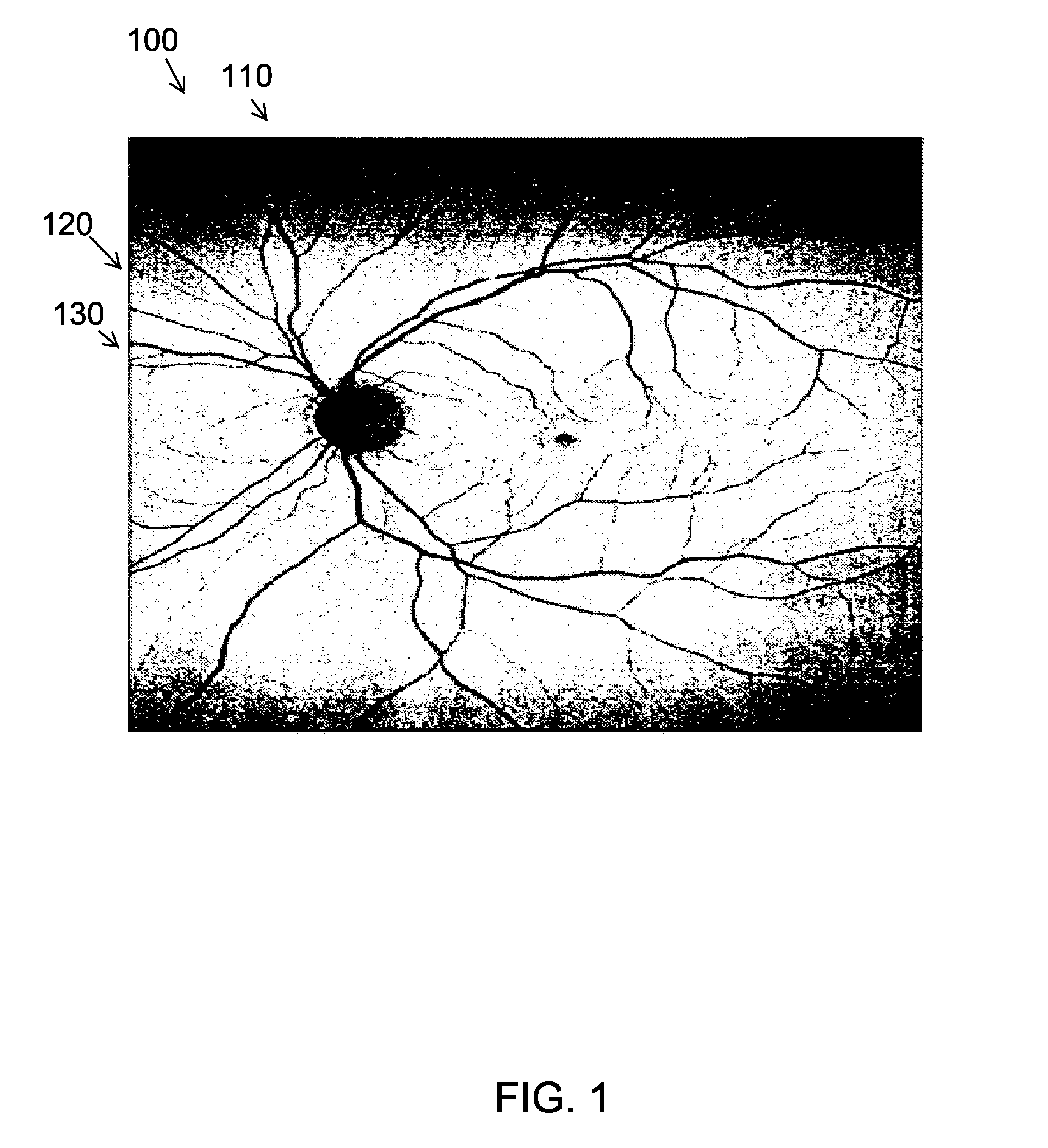 System and method for imaging a patient user's body part