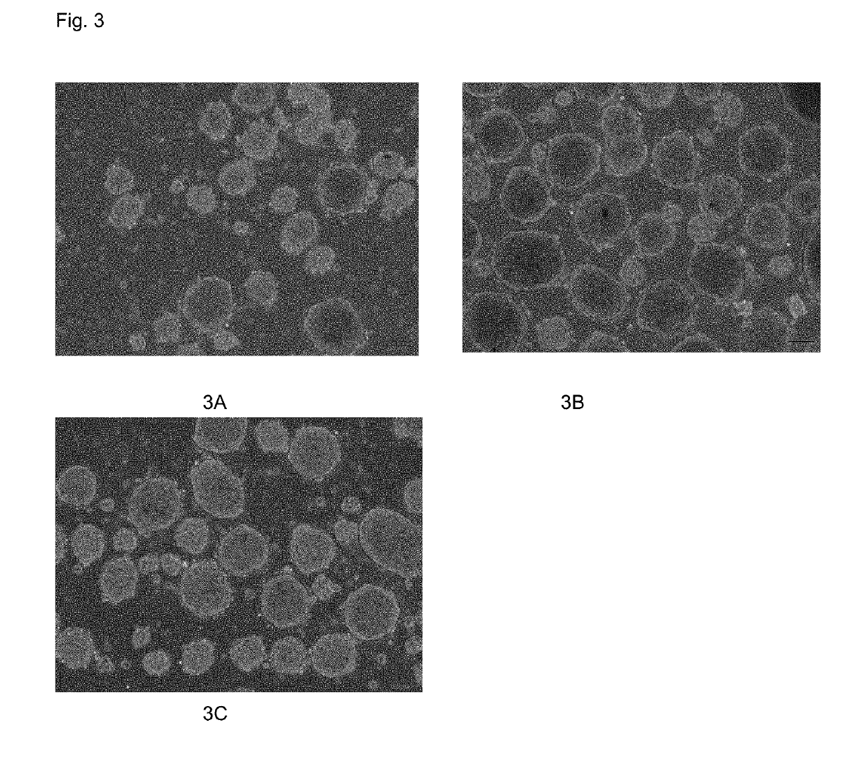 Serum-free medium inducing differentiation of umbilical cord mesenchymal stem cell into insulin-secretion-like cell and preparation method and use thereof