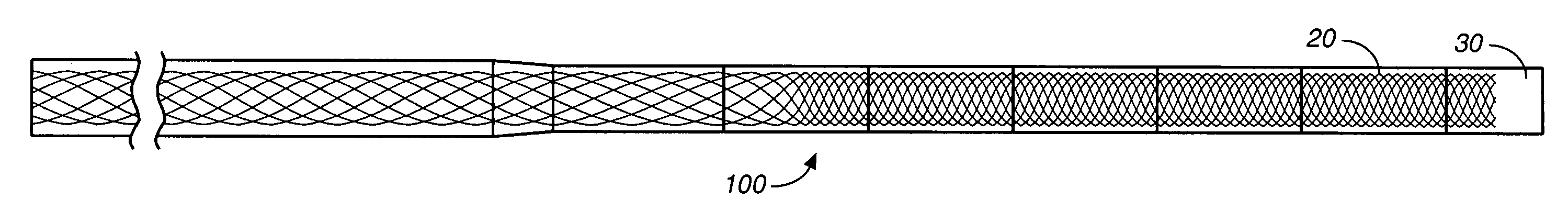 Wire braid-reinforced microcatheter