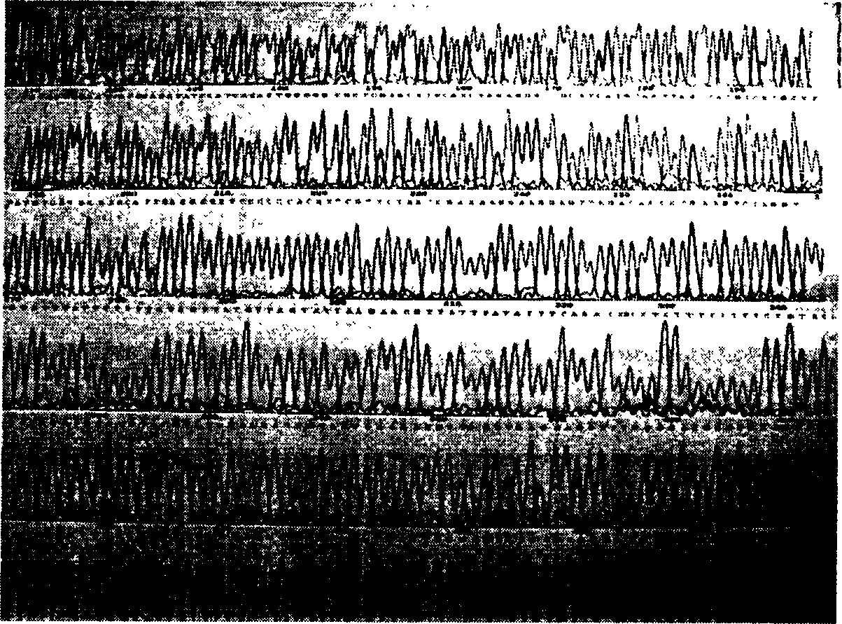 Method of expressing thymys peptide alpha by yeast and use thereof