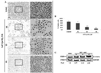 Application of astragaloside in preparation of drugs for promoting epithelization in wound healing