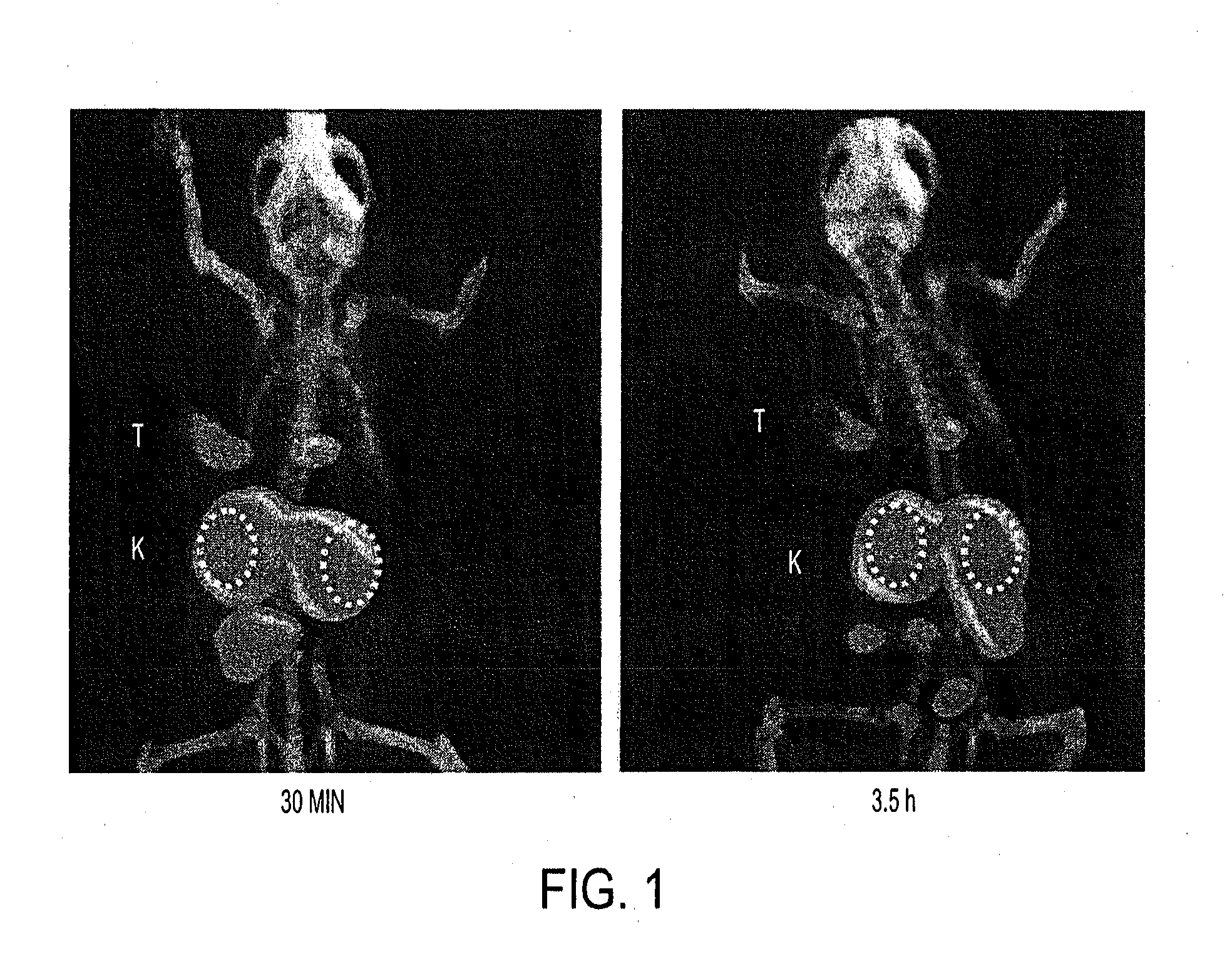 Psma-targeting compounds and uses thereof