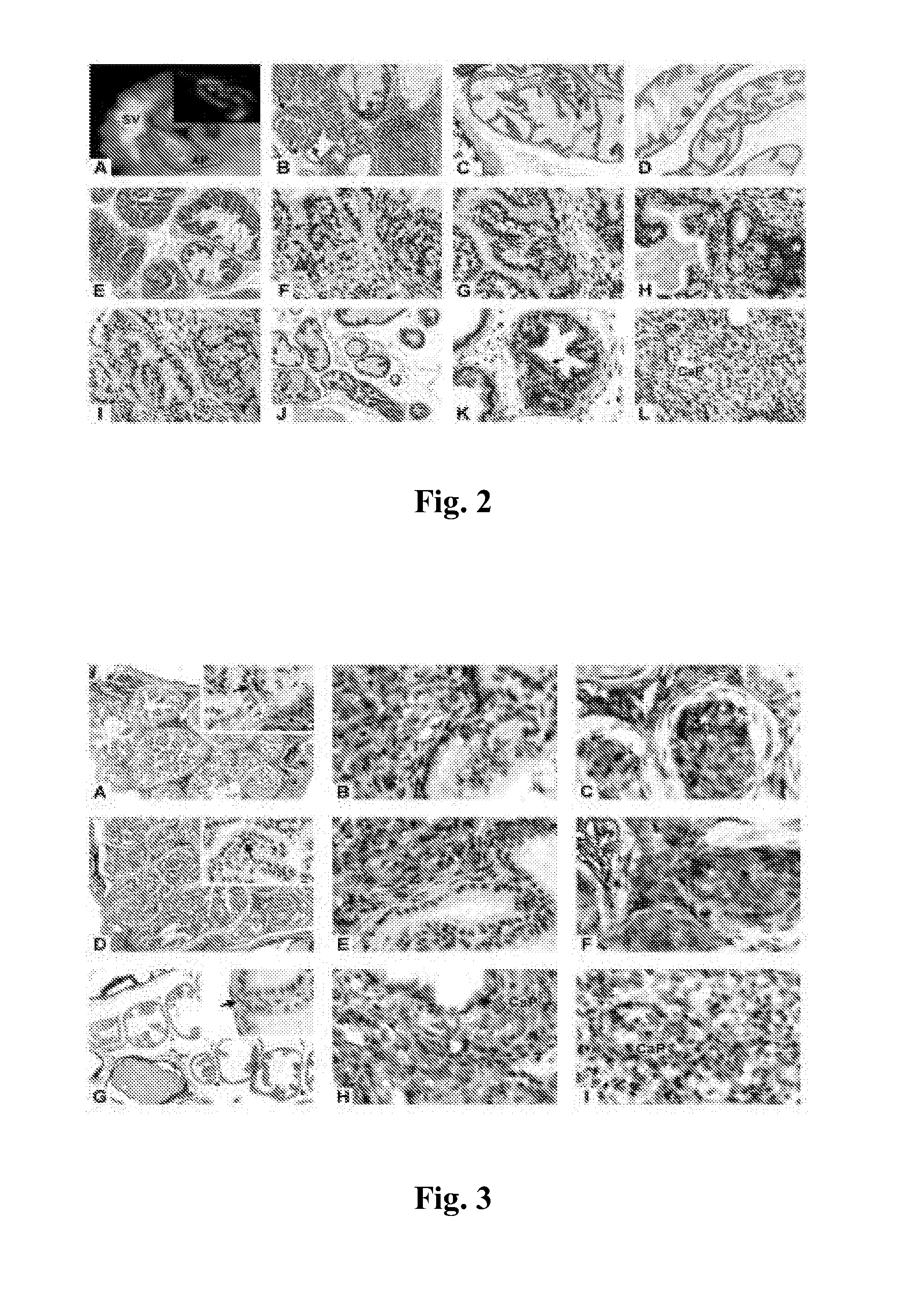 Animal Model of Prostate Cancer and Use Thereof