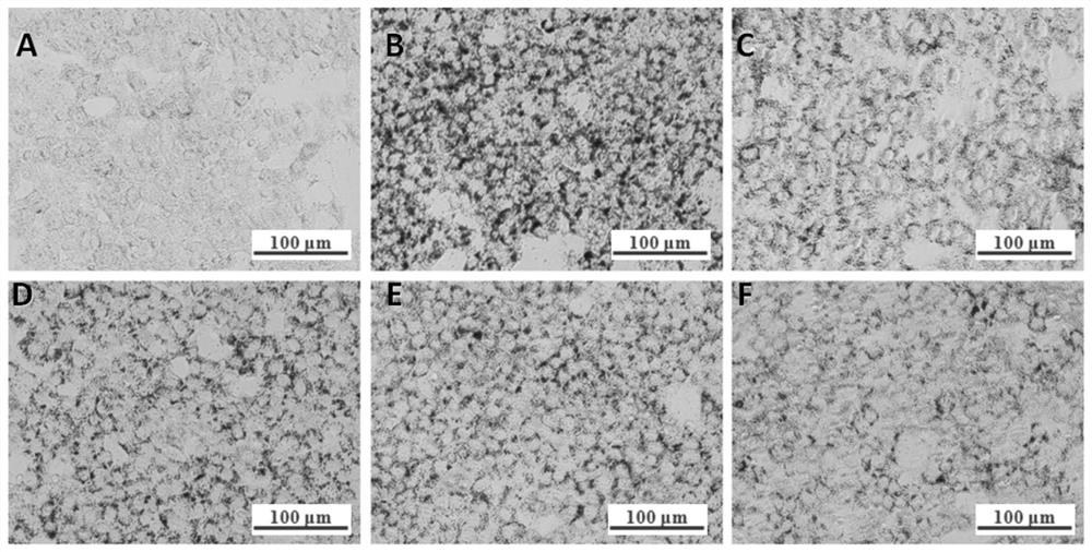 Application of taro flower polysaccharide in reducing lipid deposition in liver cells